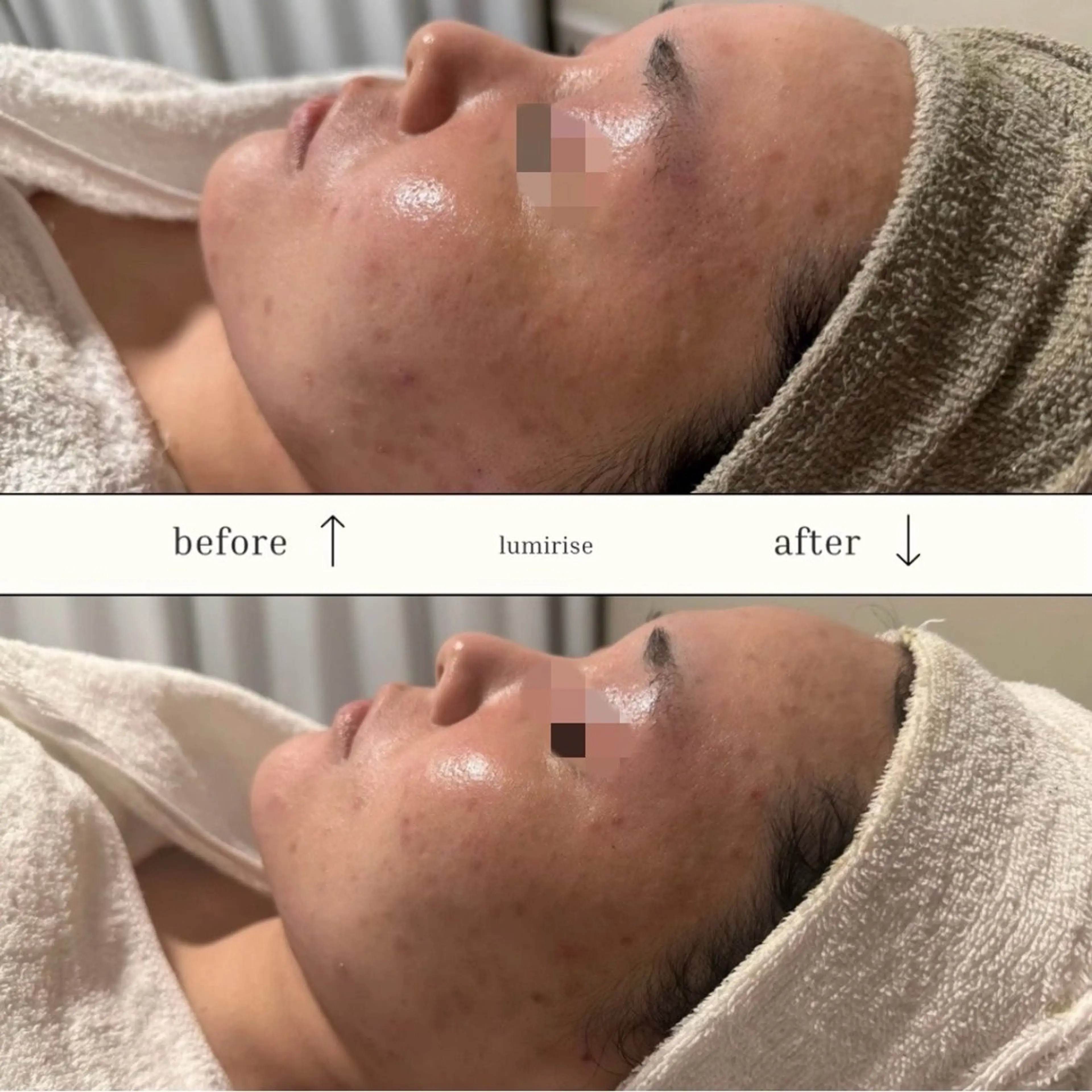 lumirise所属・lumi riseのエステ・リラクイメージ