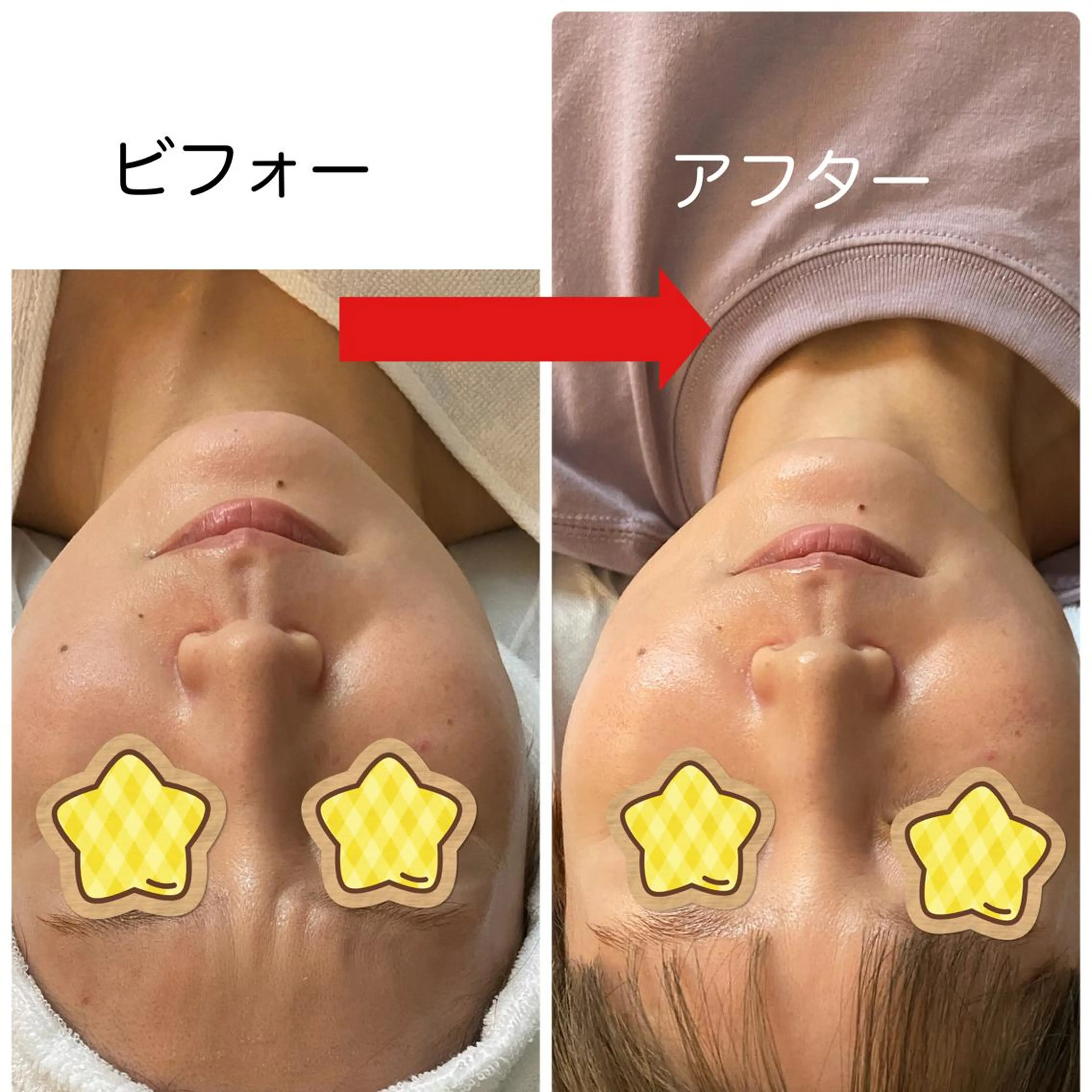 スペシャルエステ(マッサージ＋超音波＋トラブル別パック)(60分)の写真