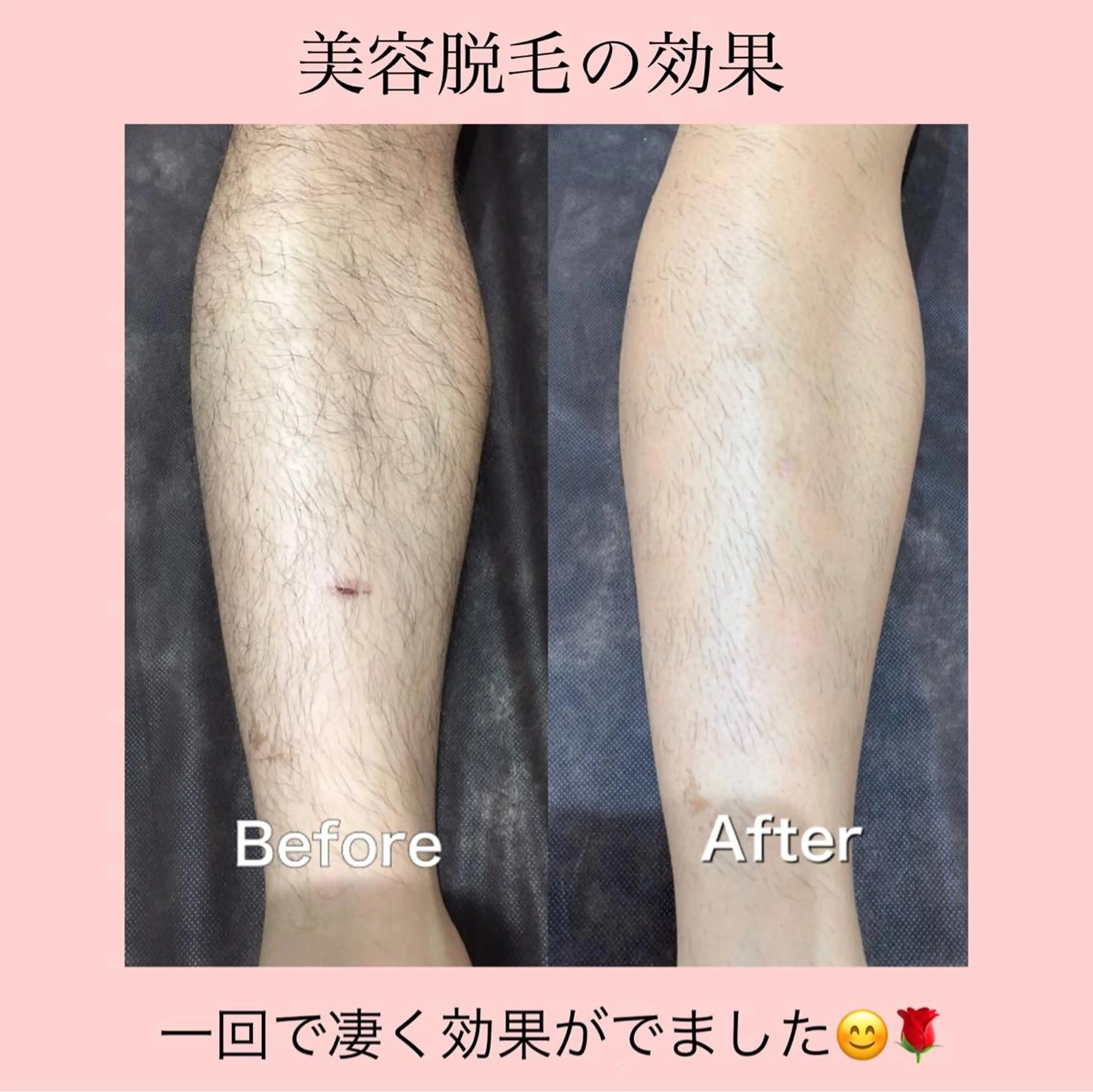 セミロング カラー パーマ ヘアアレンジ キッズ ネイル マツエク・マツパ ジェルネイル Chloe-クロエ- 脱毛/フェイシャルのエステ・リラクイメージ