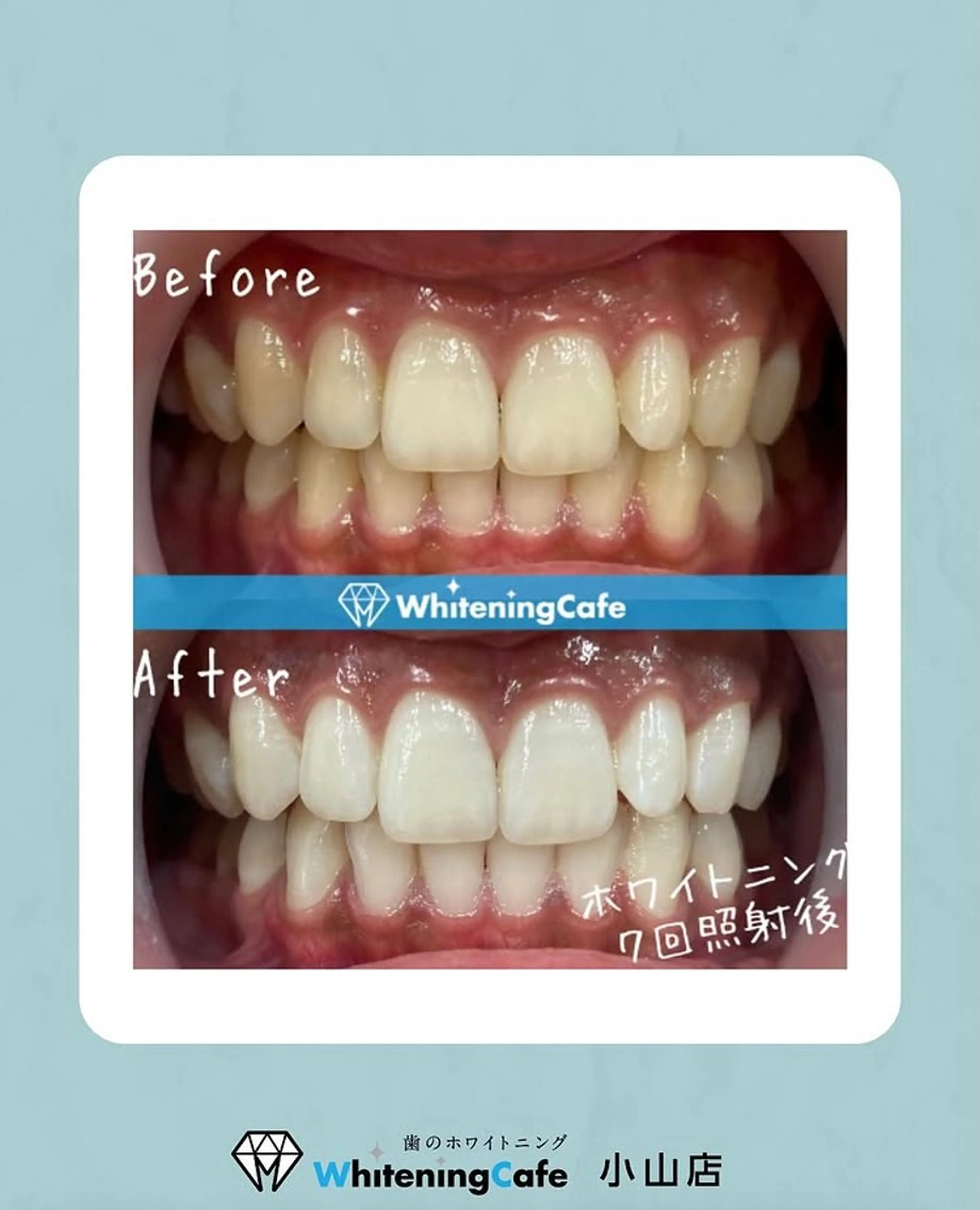 ホワイトニングカフェ 小山店のエステ・リラクイメージ