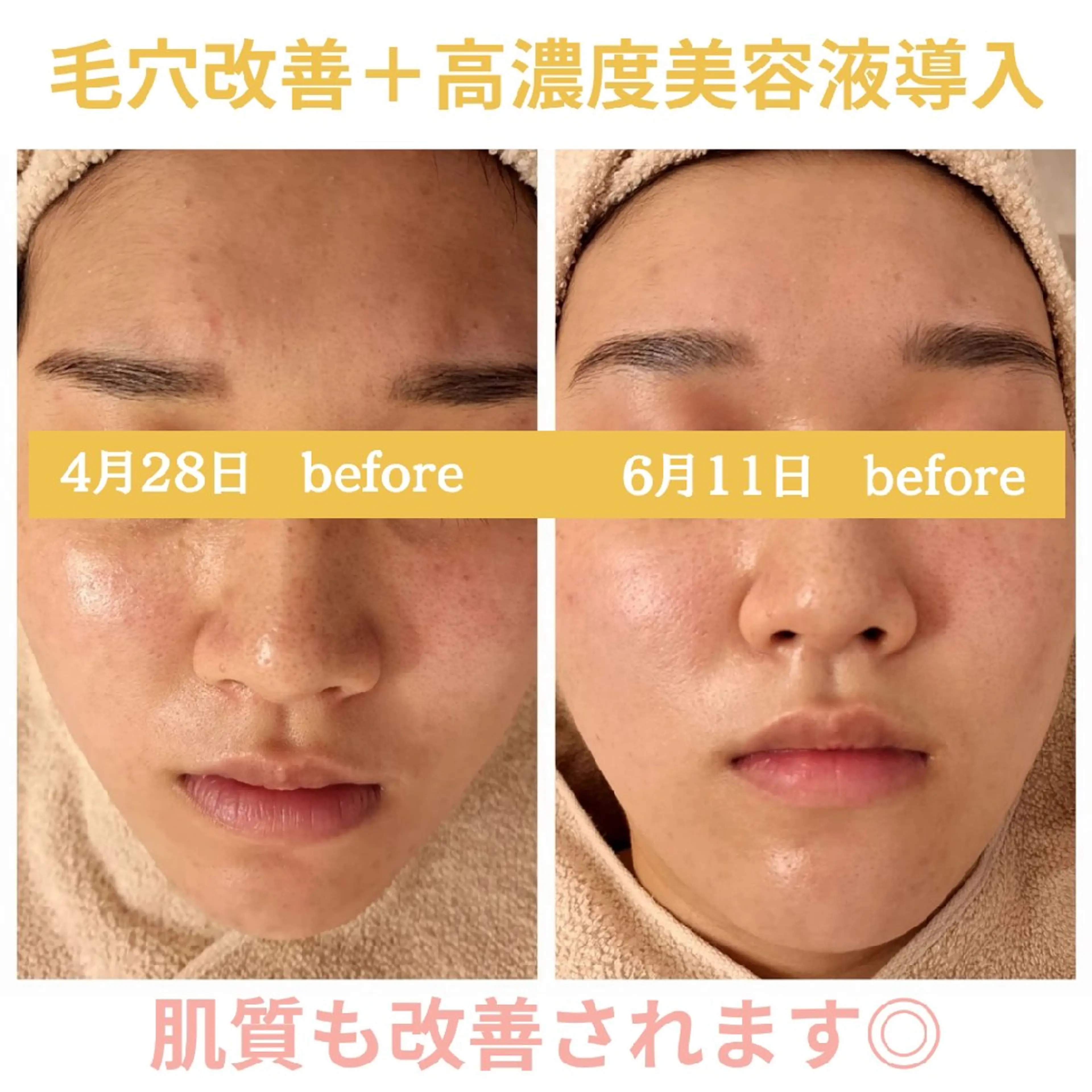 フェイシャル専門サロ ン　ERINのエステ・リラクイメージ