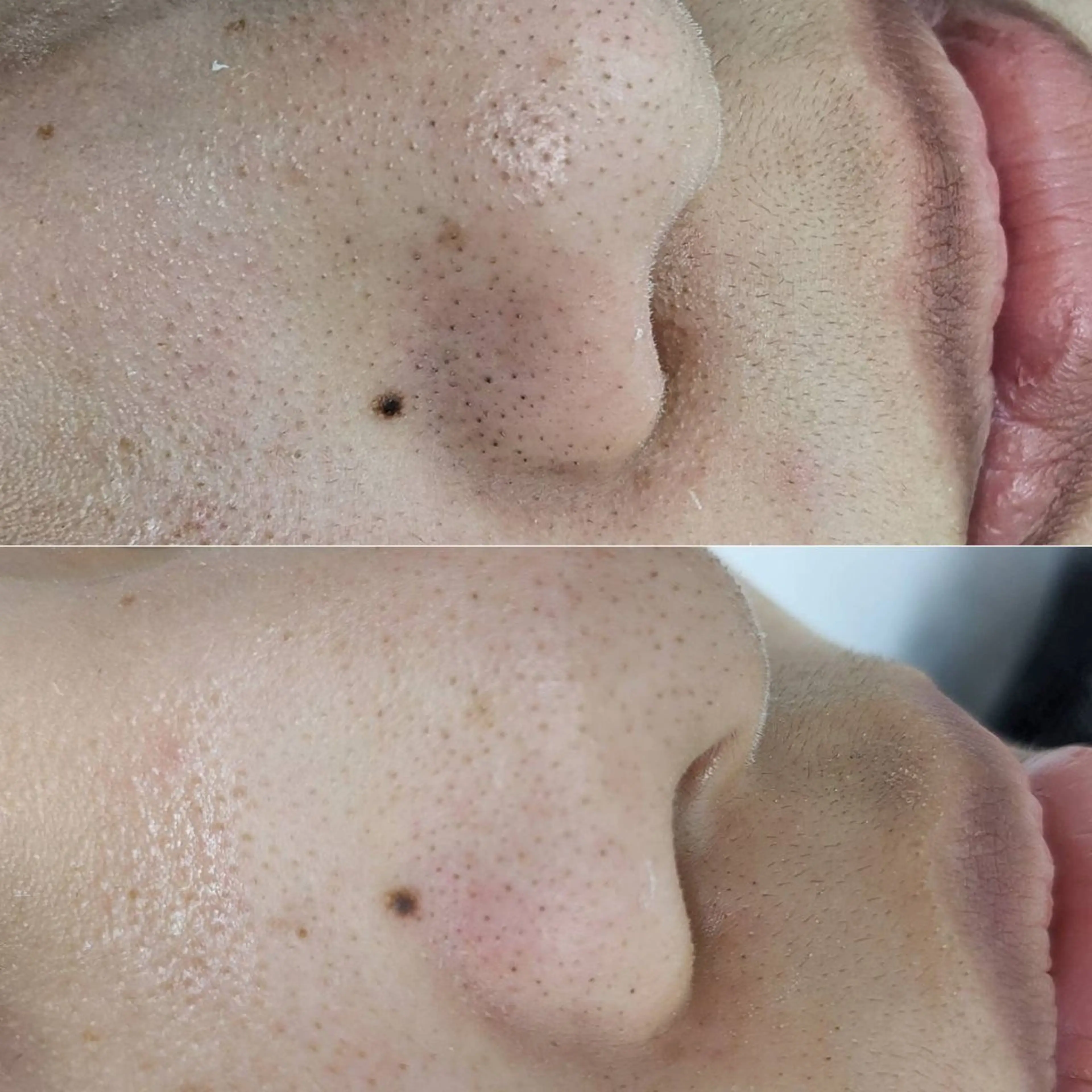 saki 束感まつ毛/ 大阪のマツエク・マツパデザイン