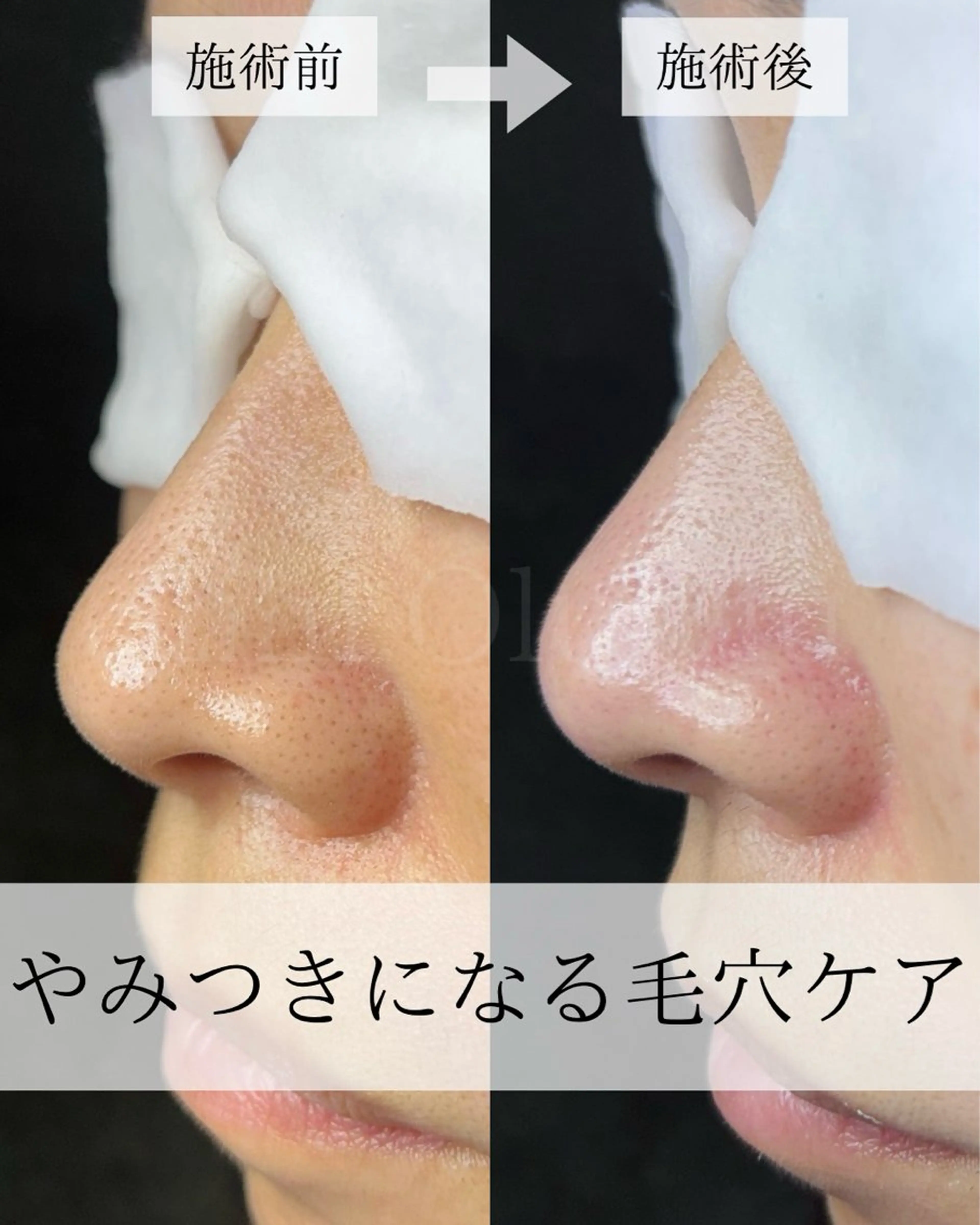 毛穴汚れ改善専門店/ 岸和田/リヒオルオルのエステ・リラクイメージ