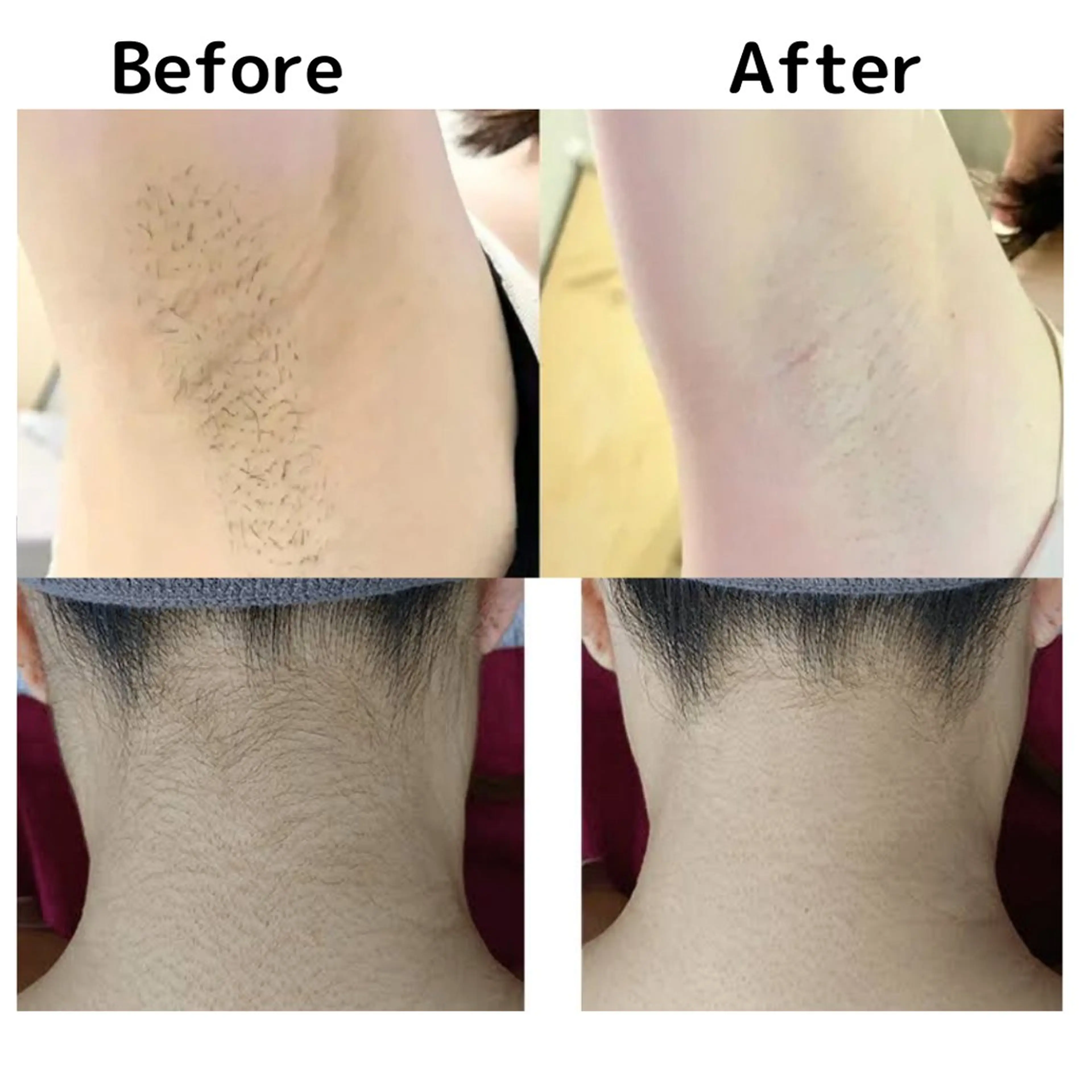 脱毛 美肌脱毛サロン muroのエステ・リラクイメージ