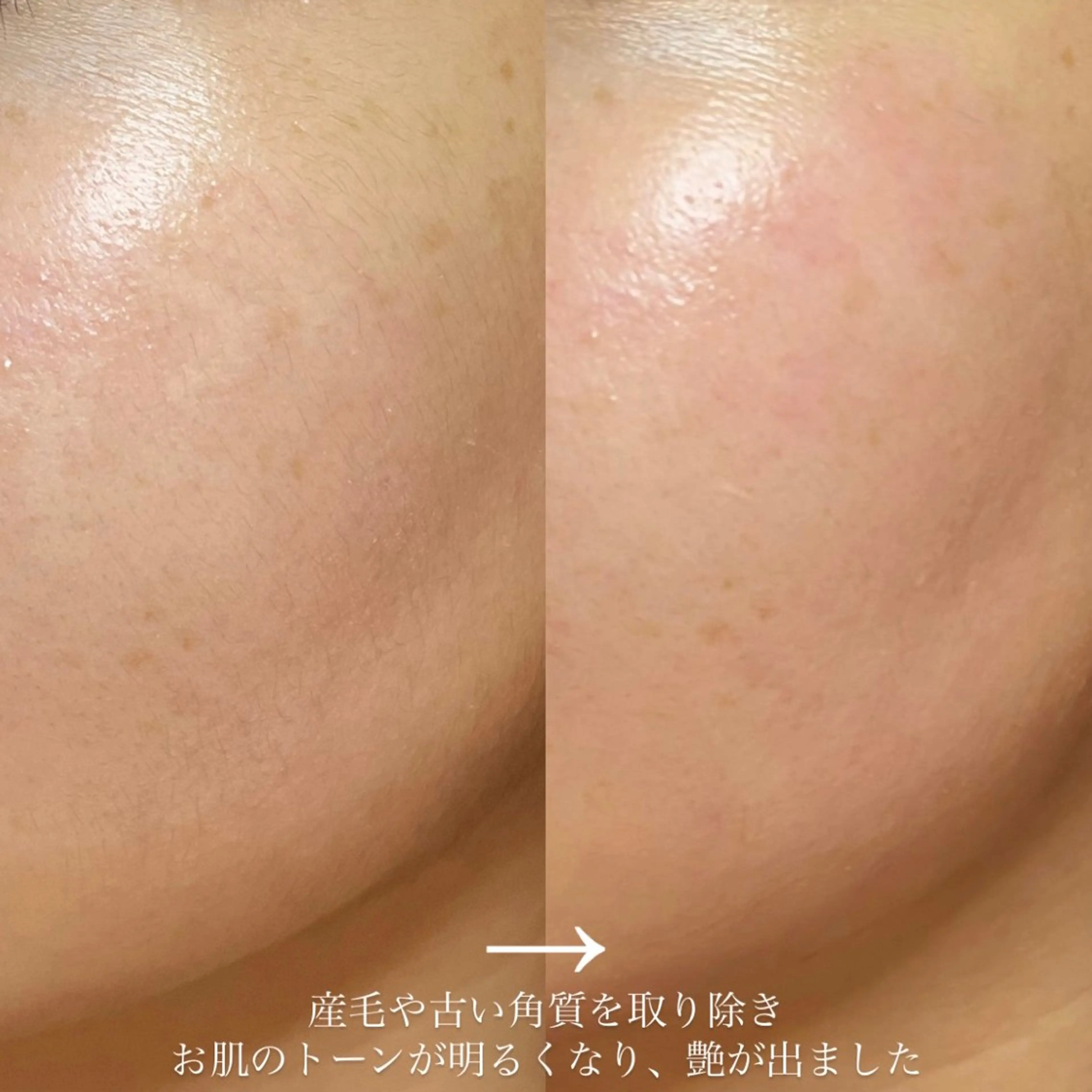 ワックス脱毛 眉カット seReno KOHAKUの眉毛・アイブロウイメージ