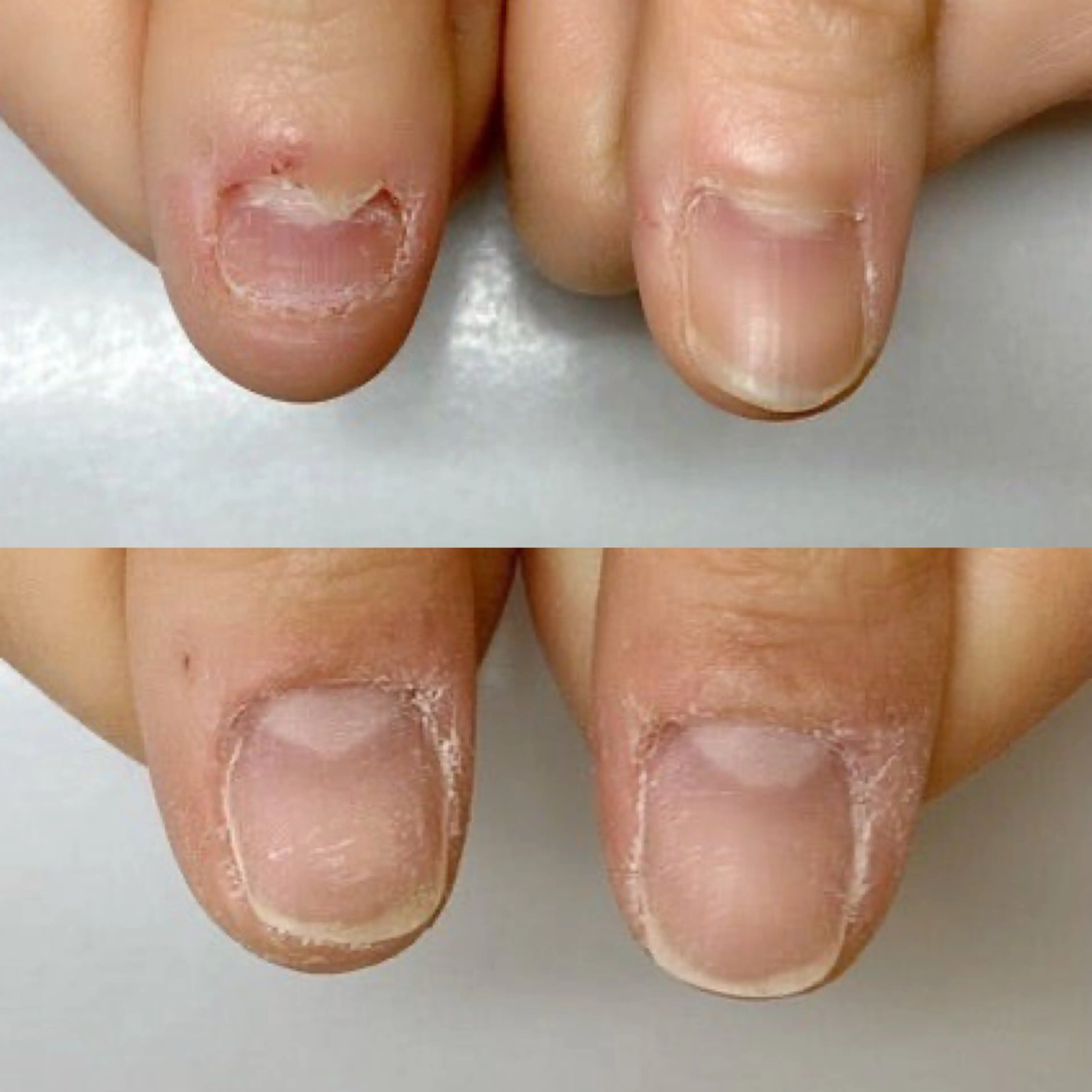 ネイル ネイルサロン アリュームのネイルデザイン