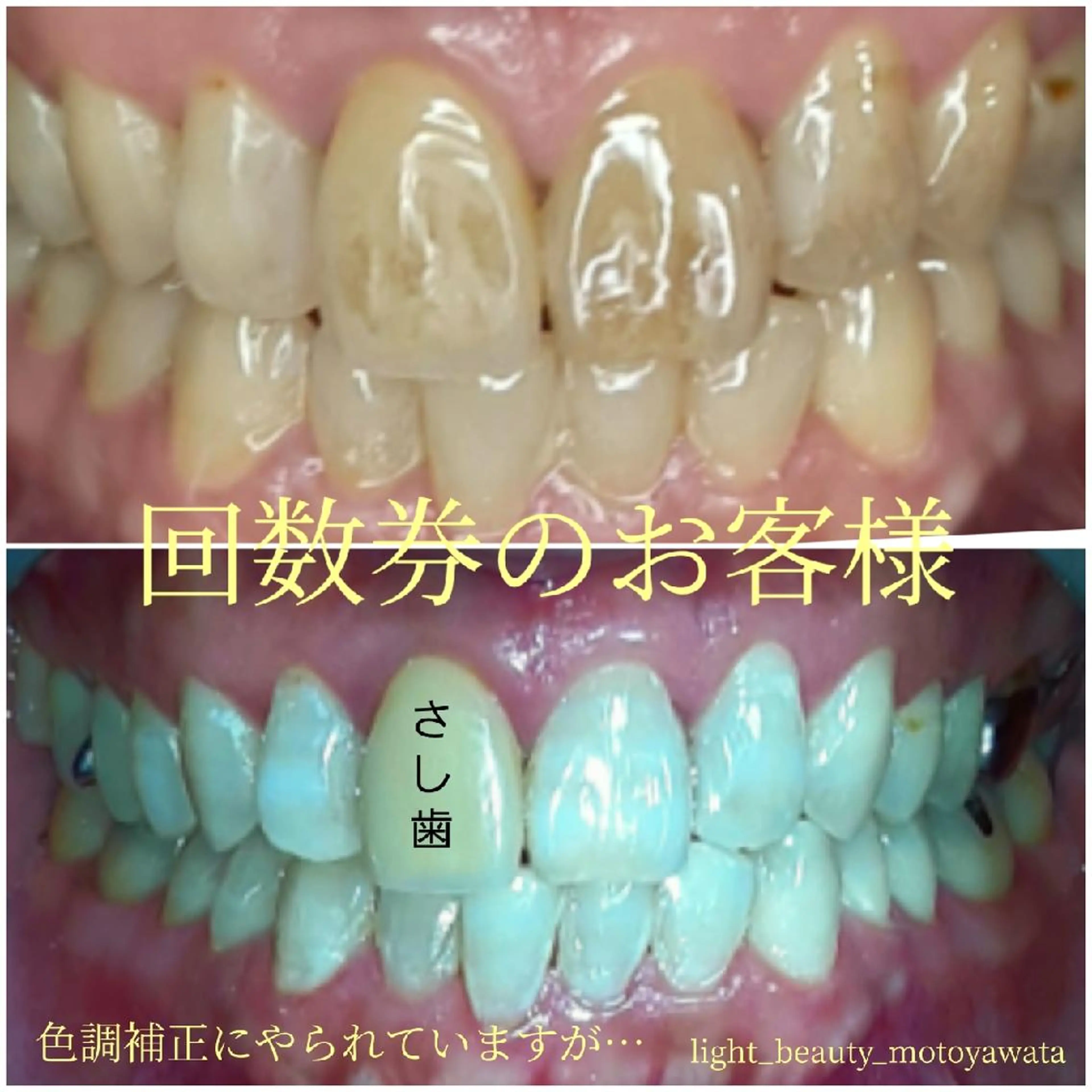 その他 五十嵐 蓮のその他イメージ