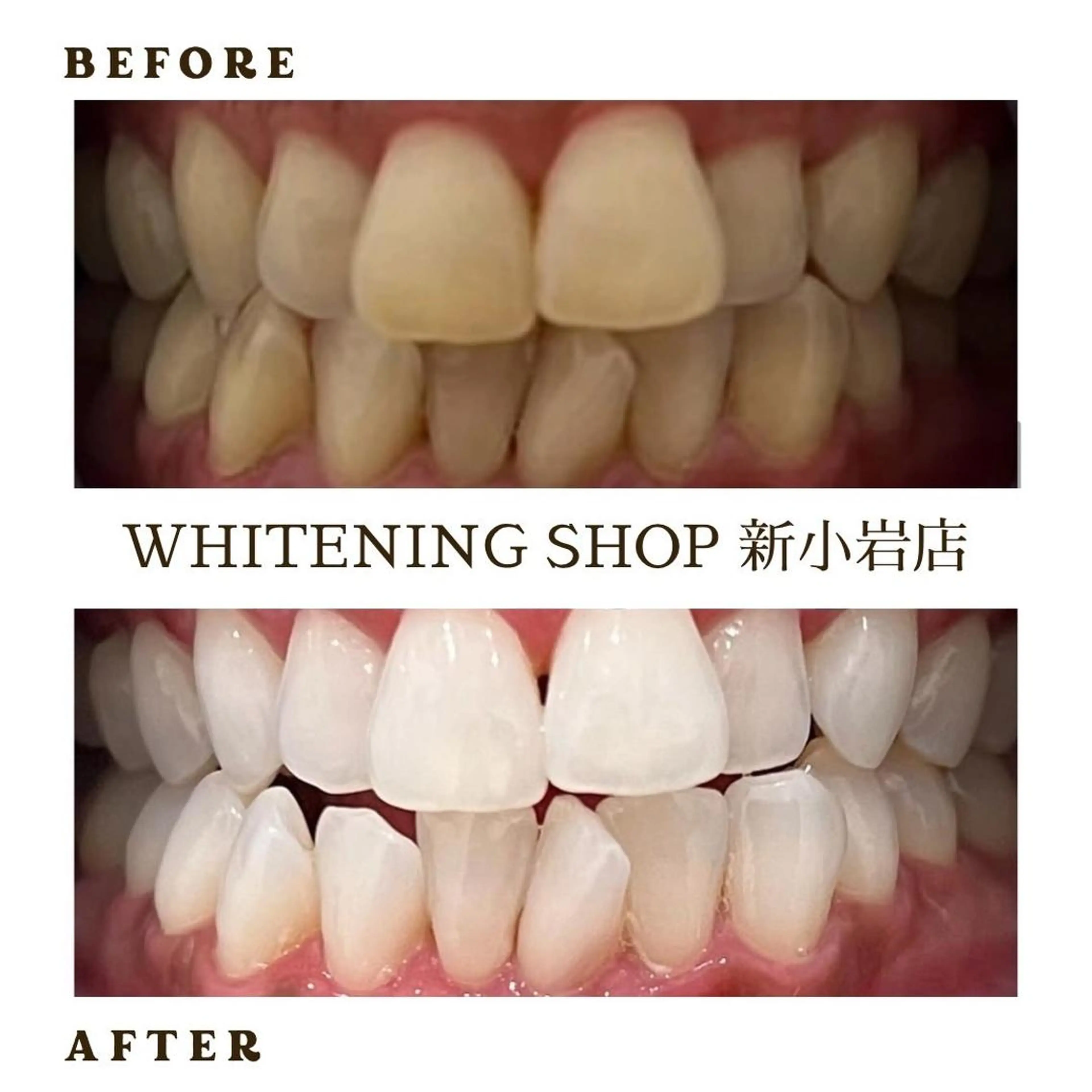 メンズ その他 ホワイトニング ショップ新小岩店のその他イメージ