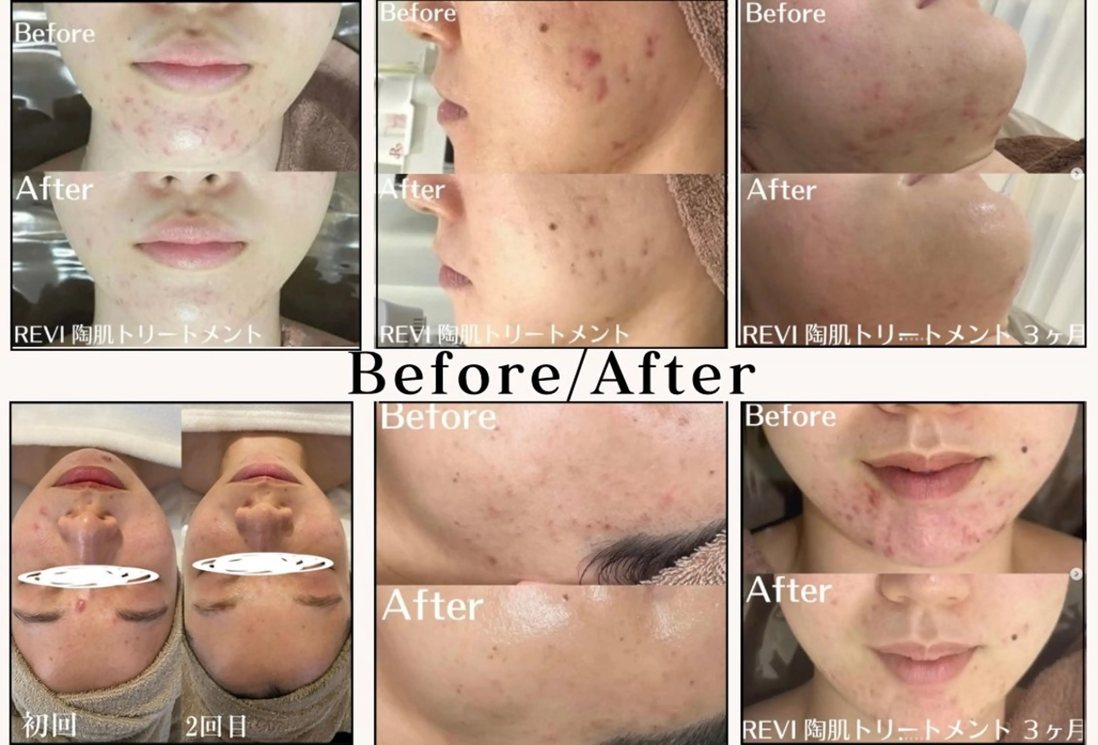 中目黒ハーブピーリン グ🌿ララピールのエステ・リラクイメージ