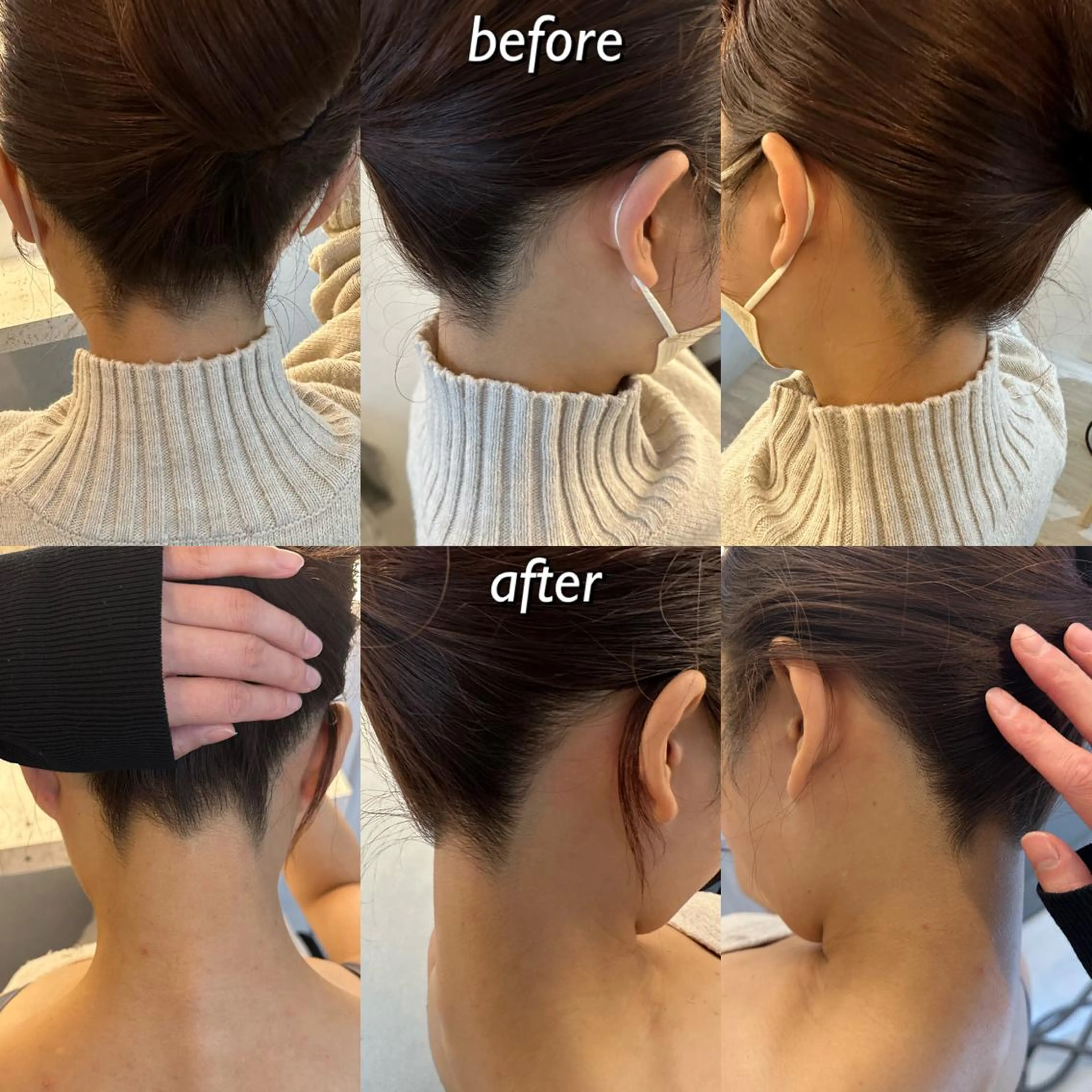 うなじ脱毛/美肌脱毛 LABELのエステ・リラクイメージ