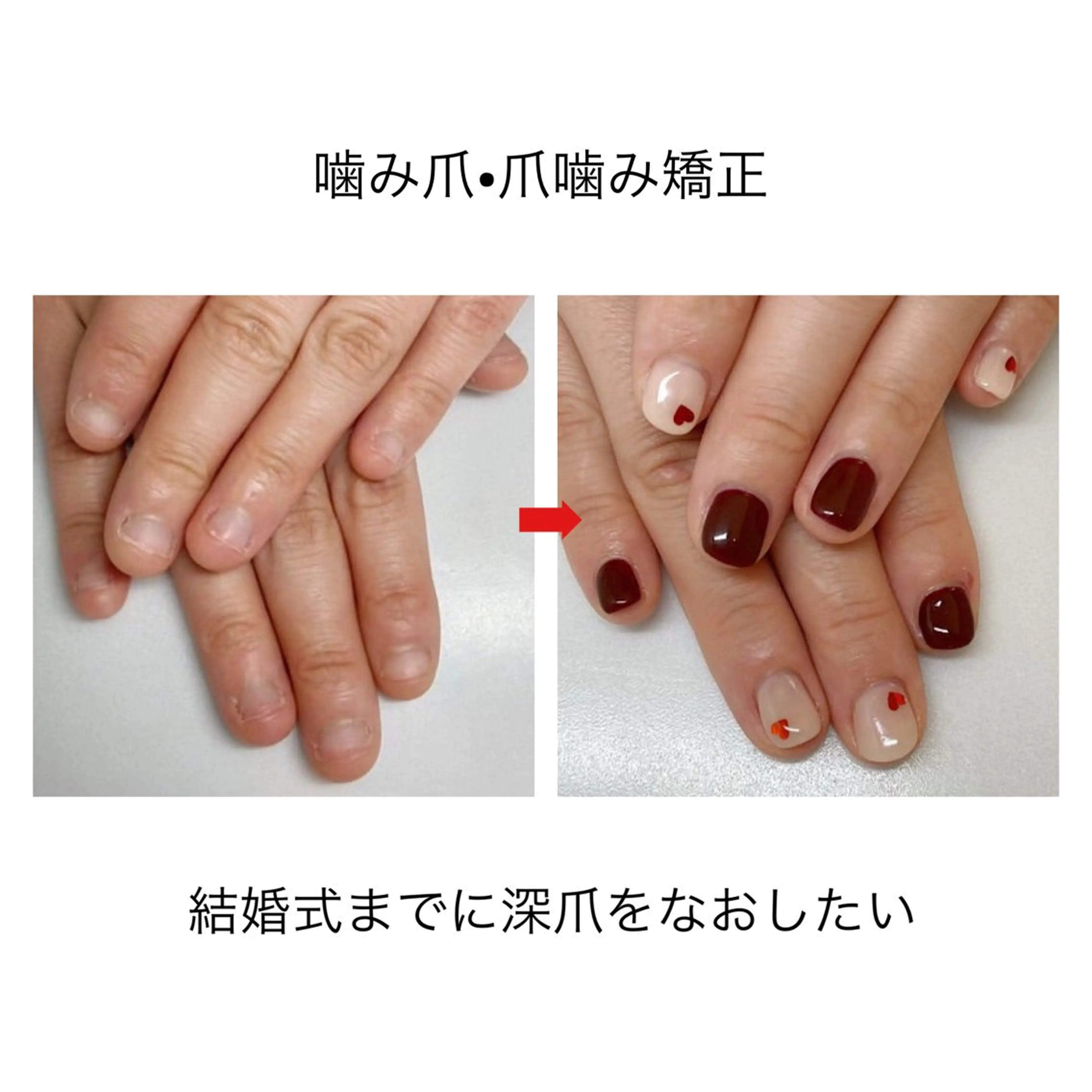 ネイル ネイルサロン アリュームのネイルデザイン