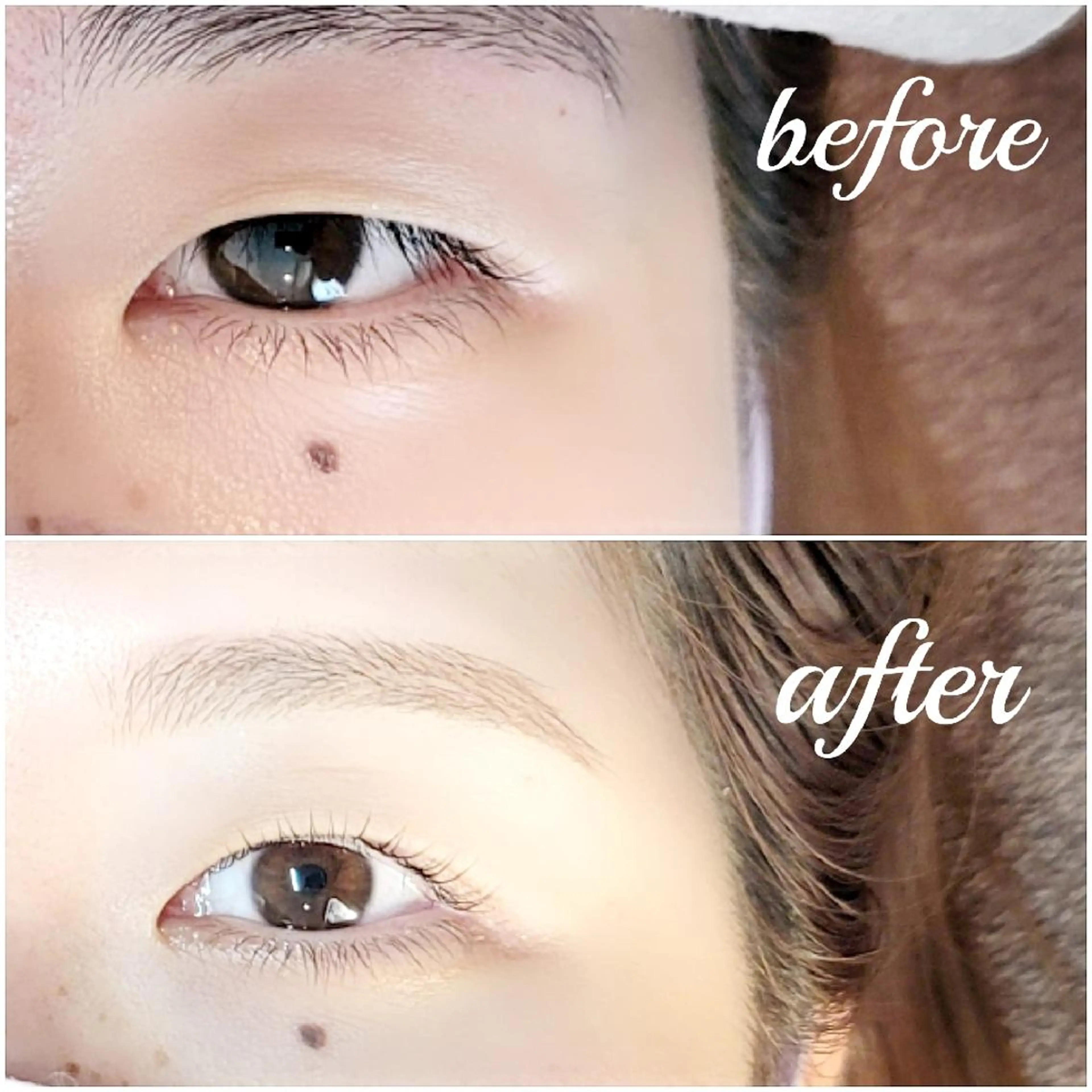 アイストレッチのみ(ダブルアイリフト)の写真