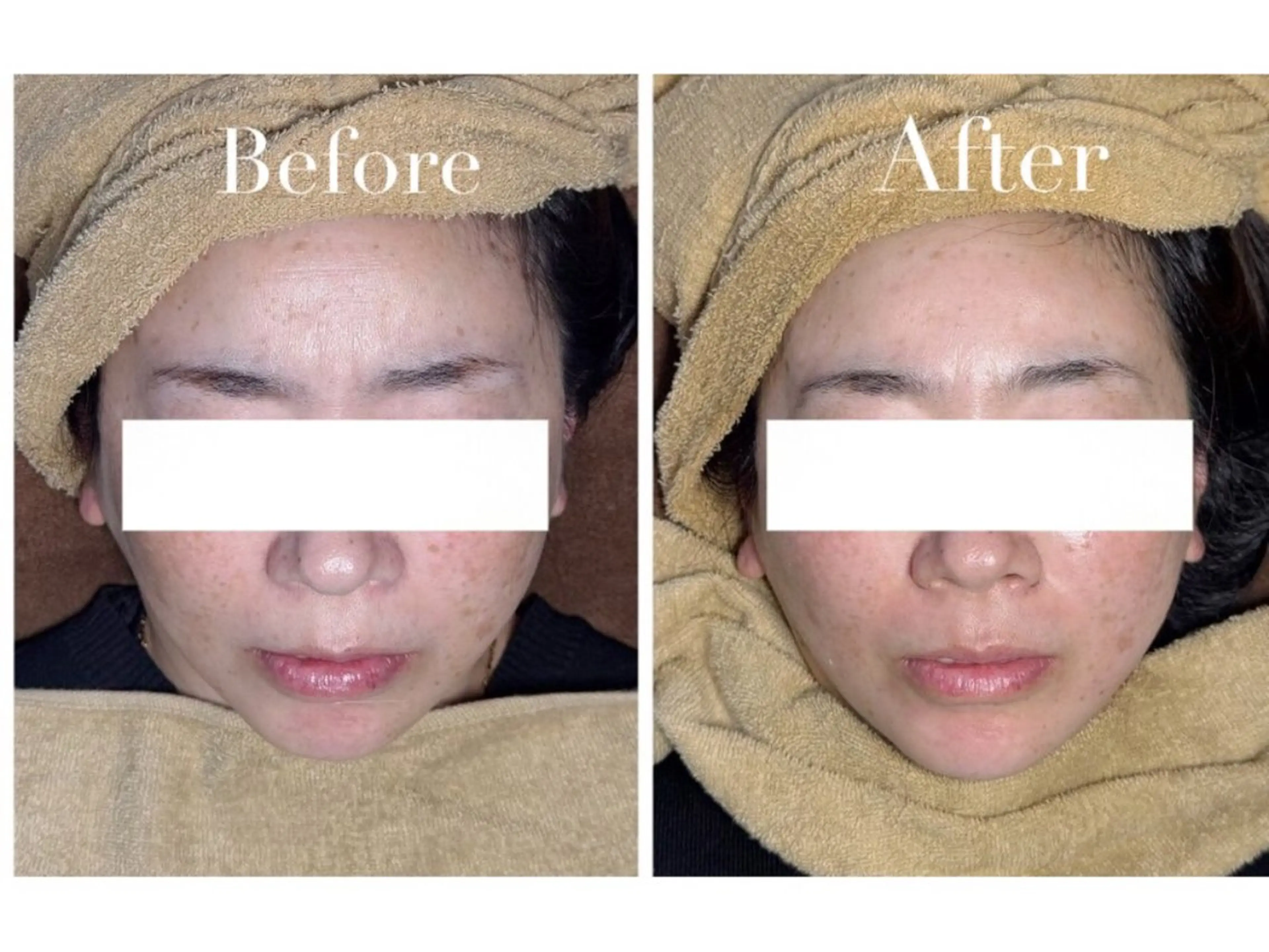 エステ Avenir Brillant所属・松田 紗季のエステ・リラクイメージ