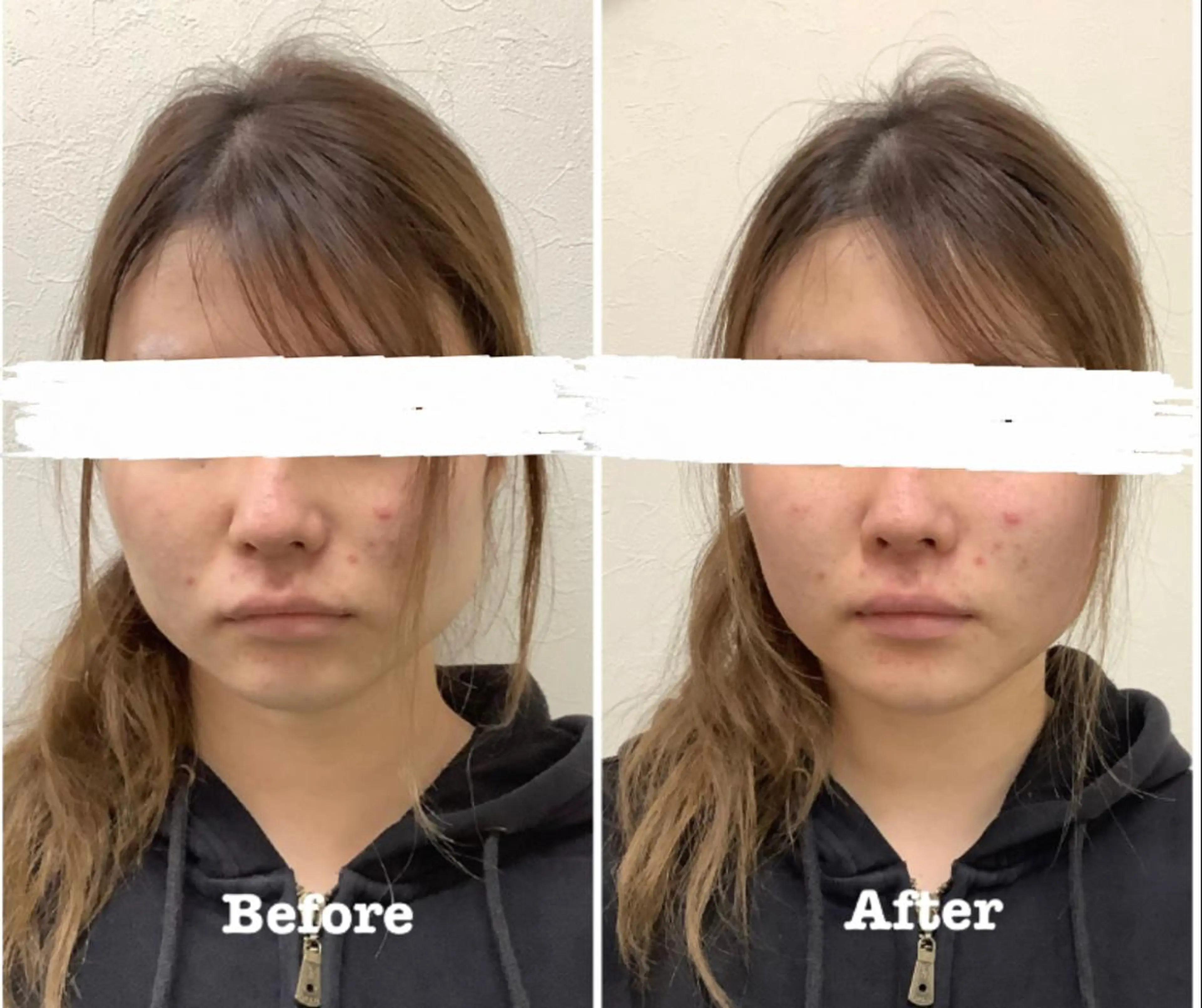 エステ リラク だいち 鍼灸院　伊伝居院のエステ・リラクイメージ