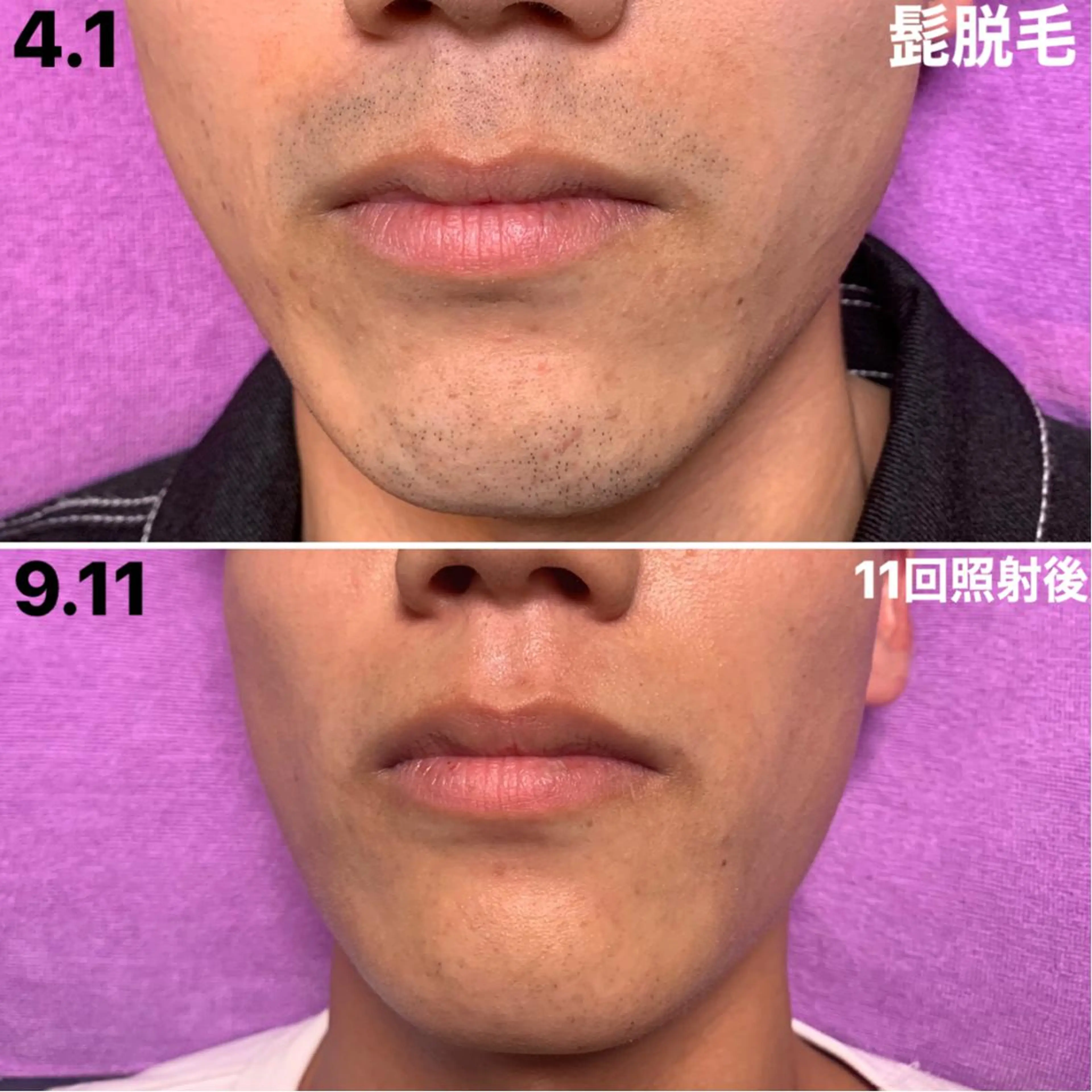 メンズ 森谷 莉美のエステ・リラクイメージ