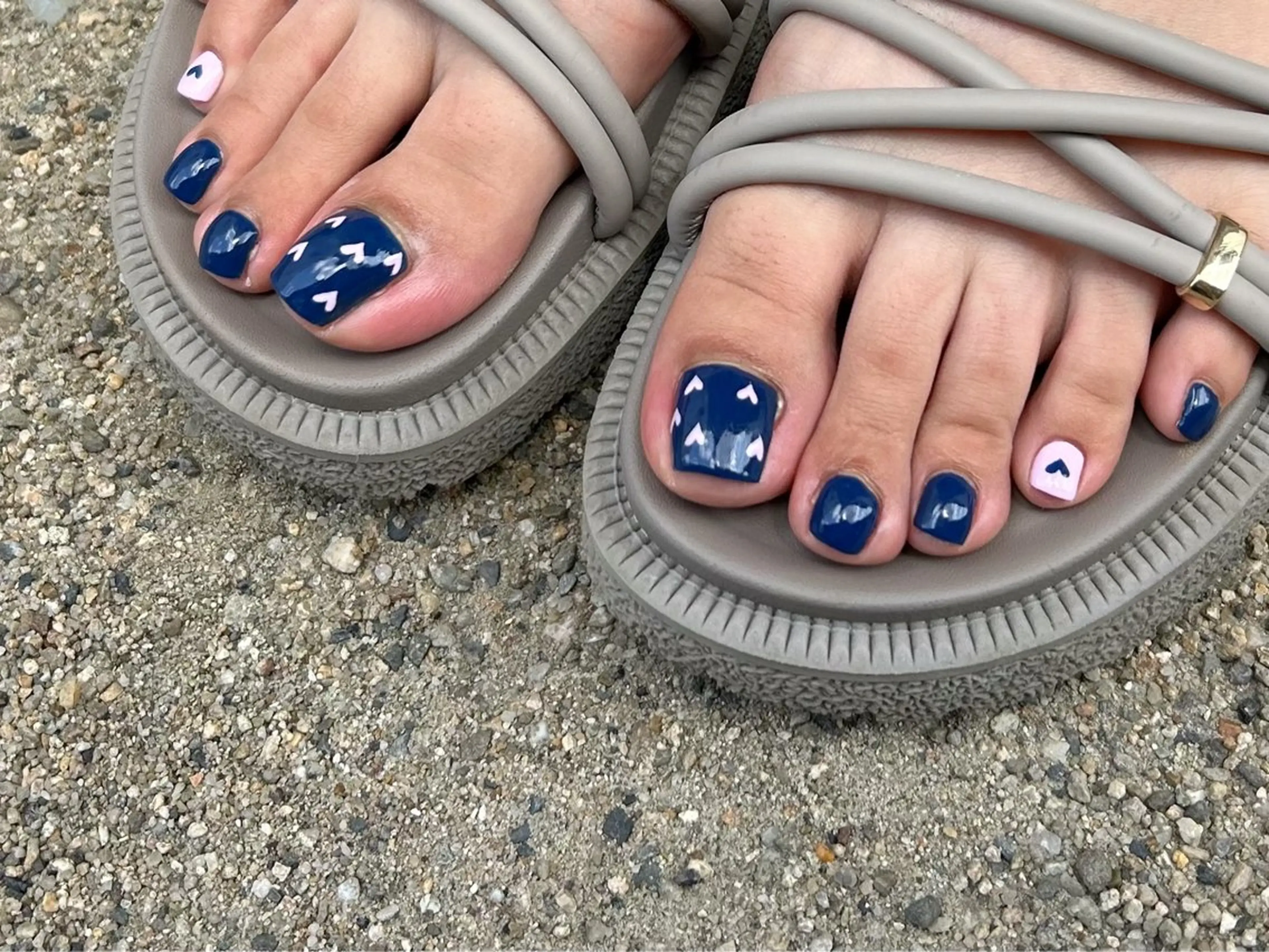 ネイル フットネイル Lofinails ちひろのネイルデザイン