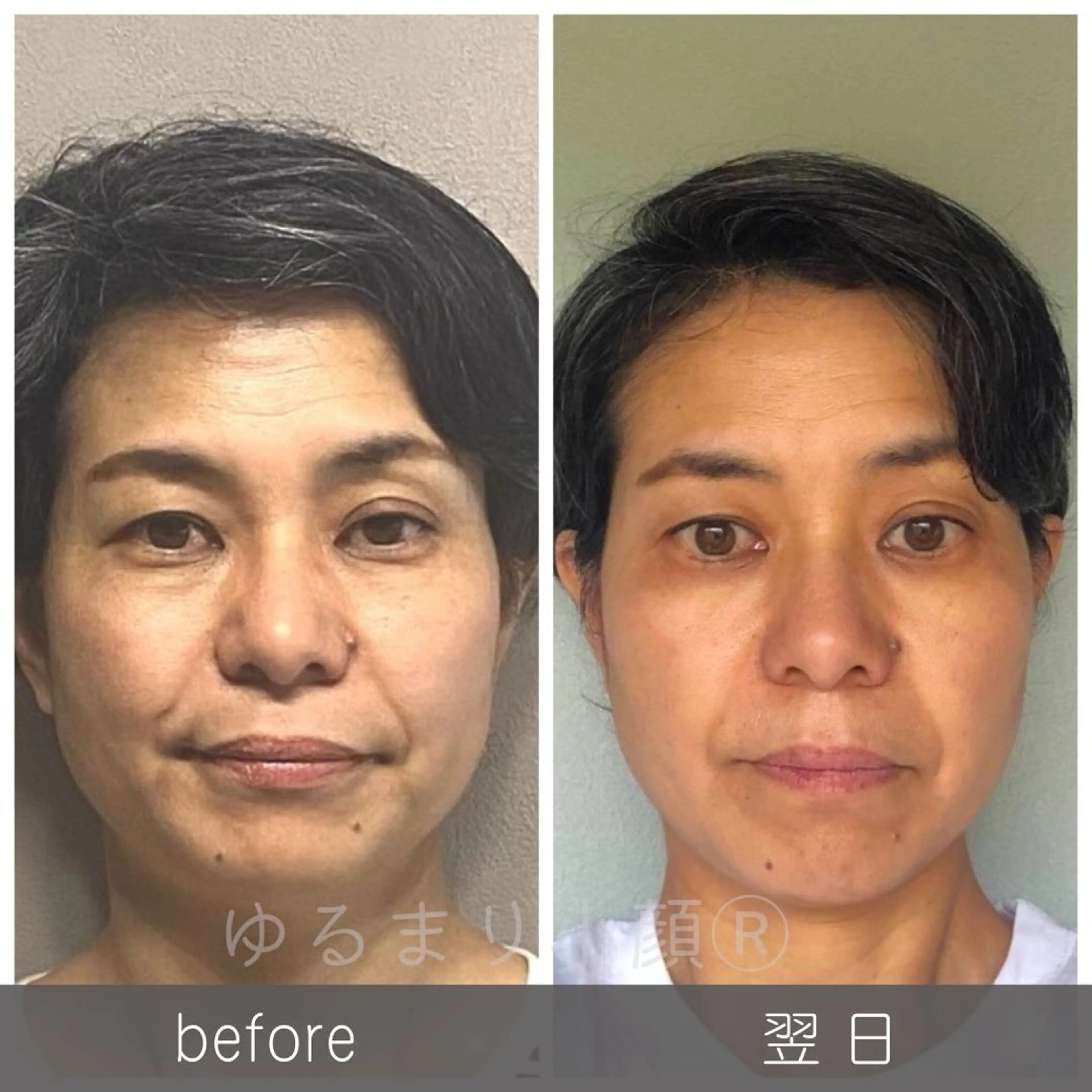 小顔矯正サロン町田 逸見智美のエステ・リラクイメージ