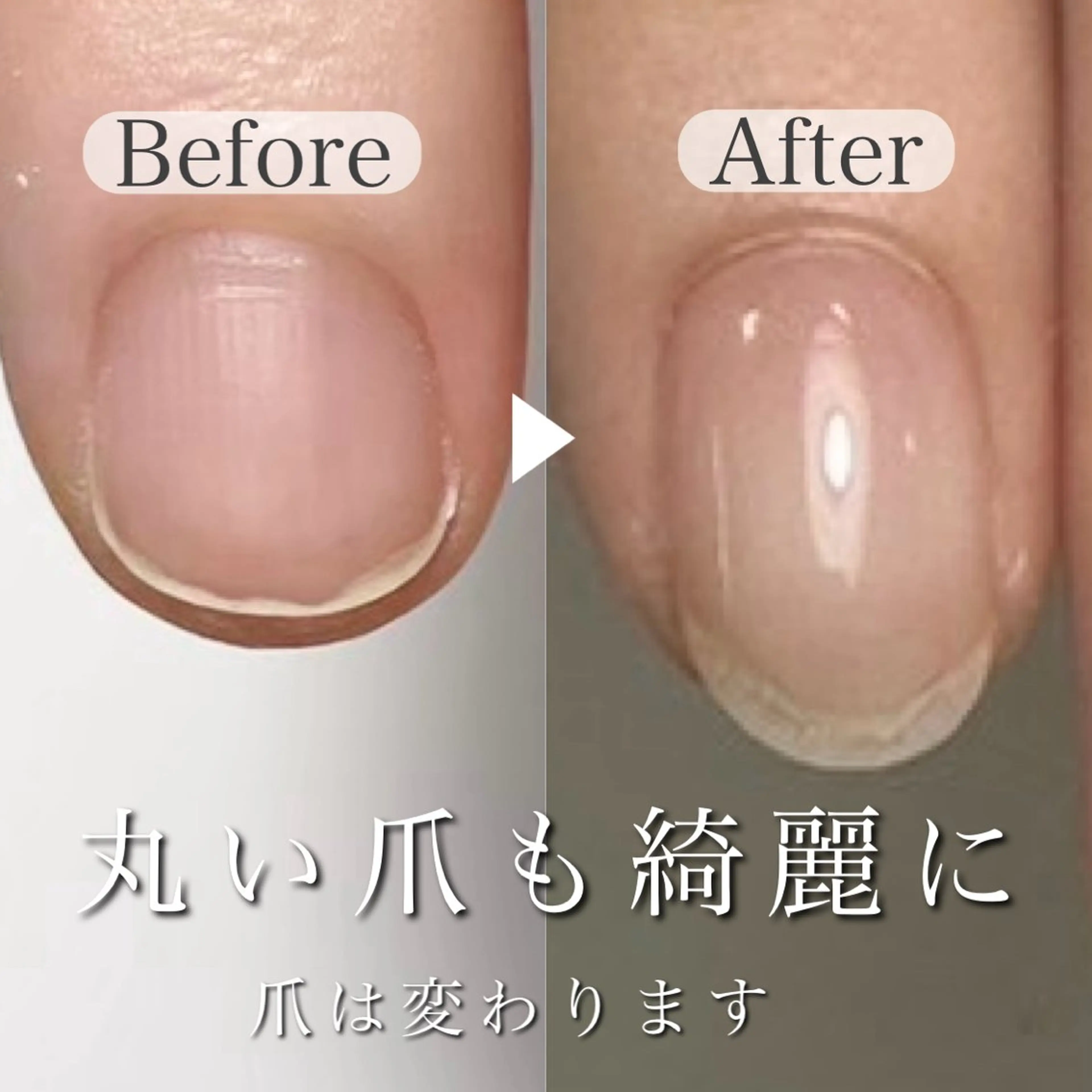 ネイル 深爪専門店 サロンリリーのネイルデザイン