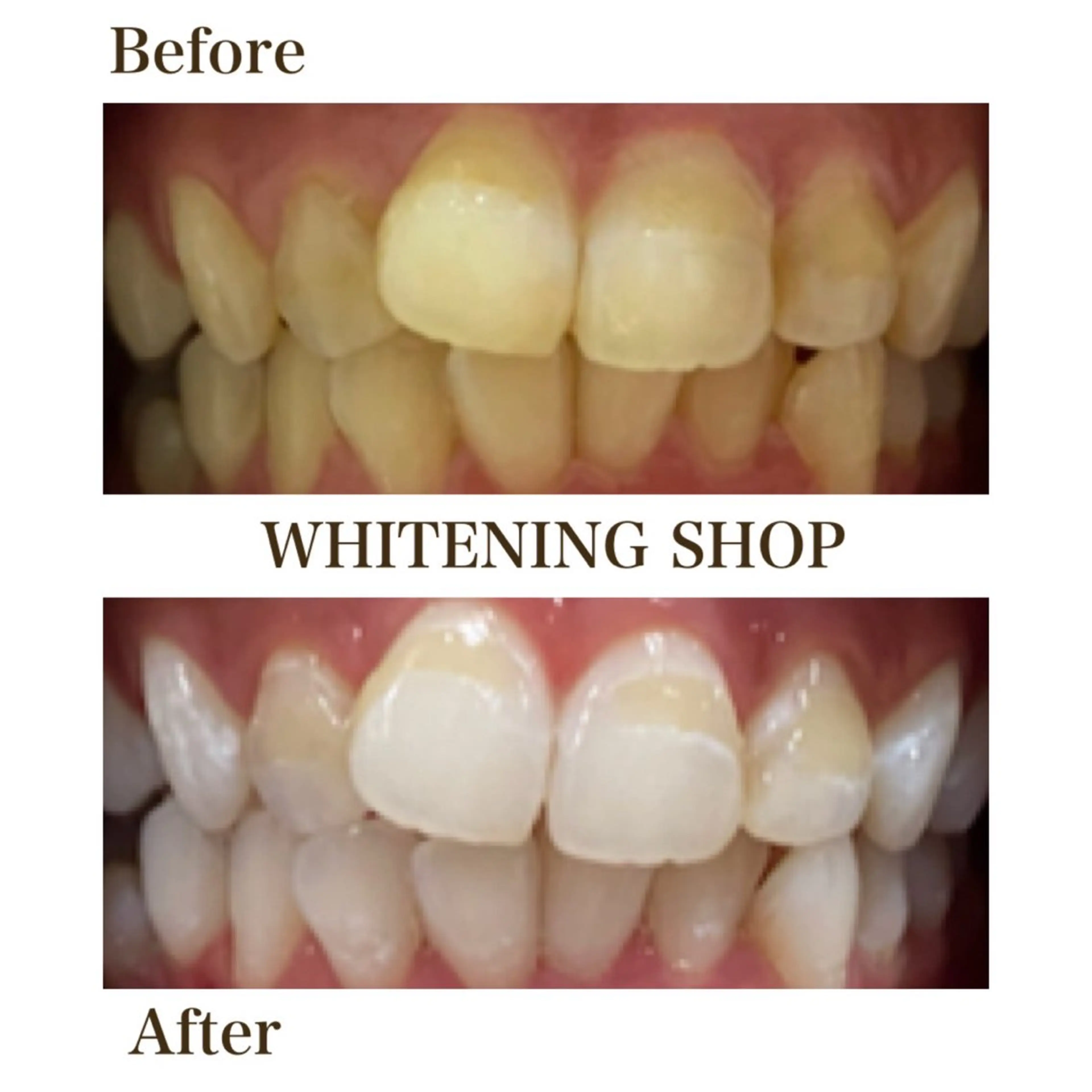 エステ リラク ホワイトニング ショップ川越店のエステ・リラクイメージ