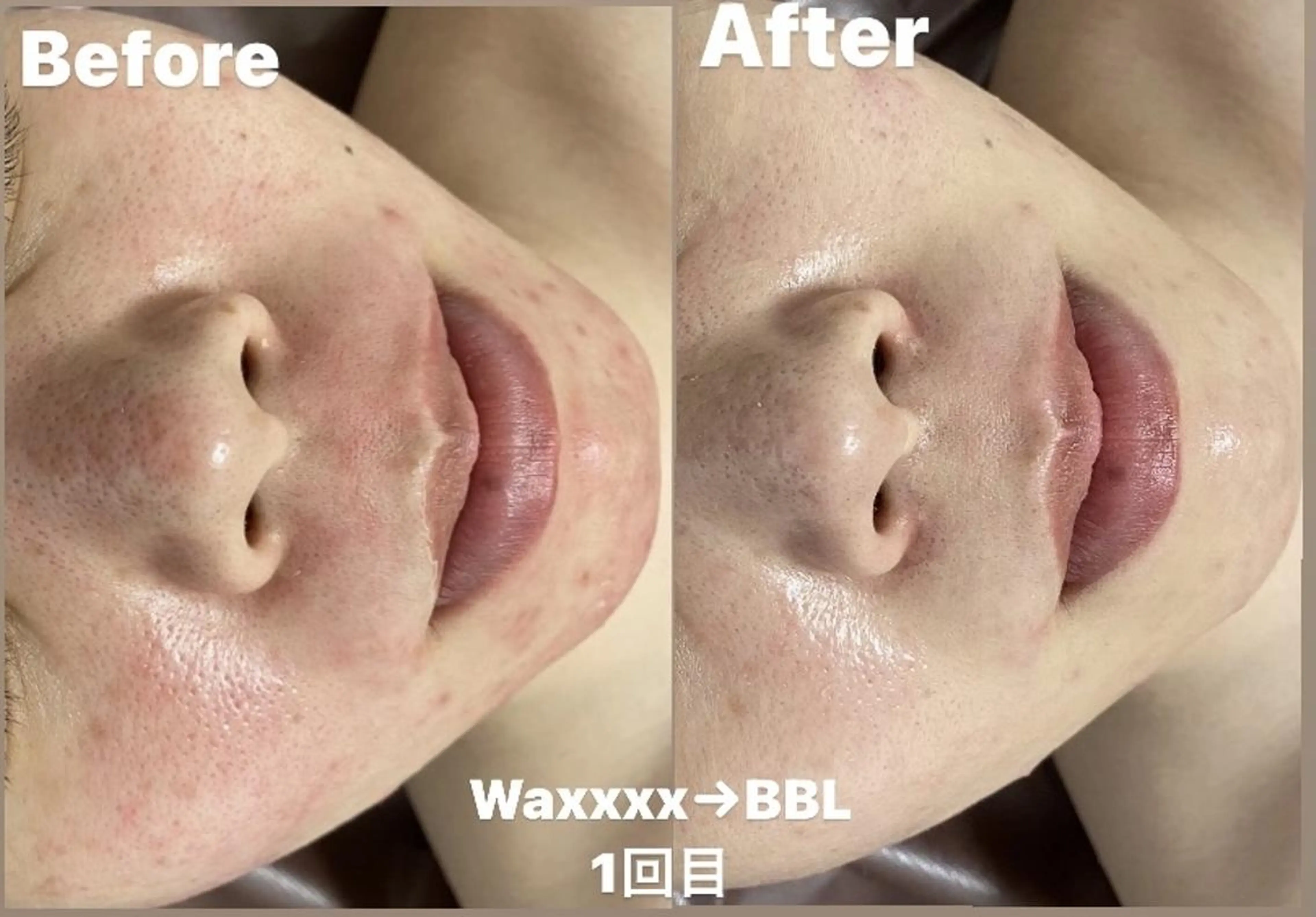 脱毛 Epina 千葉店 【エピナ】のエステ・リラクイメージ