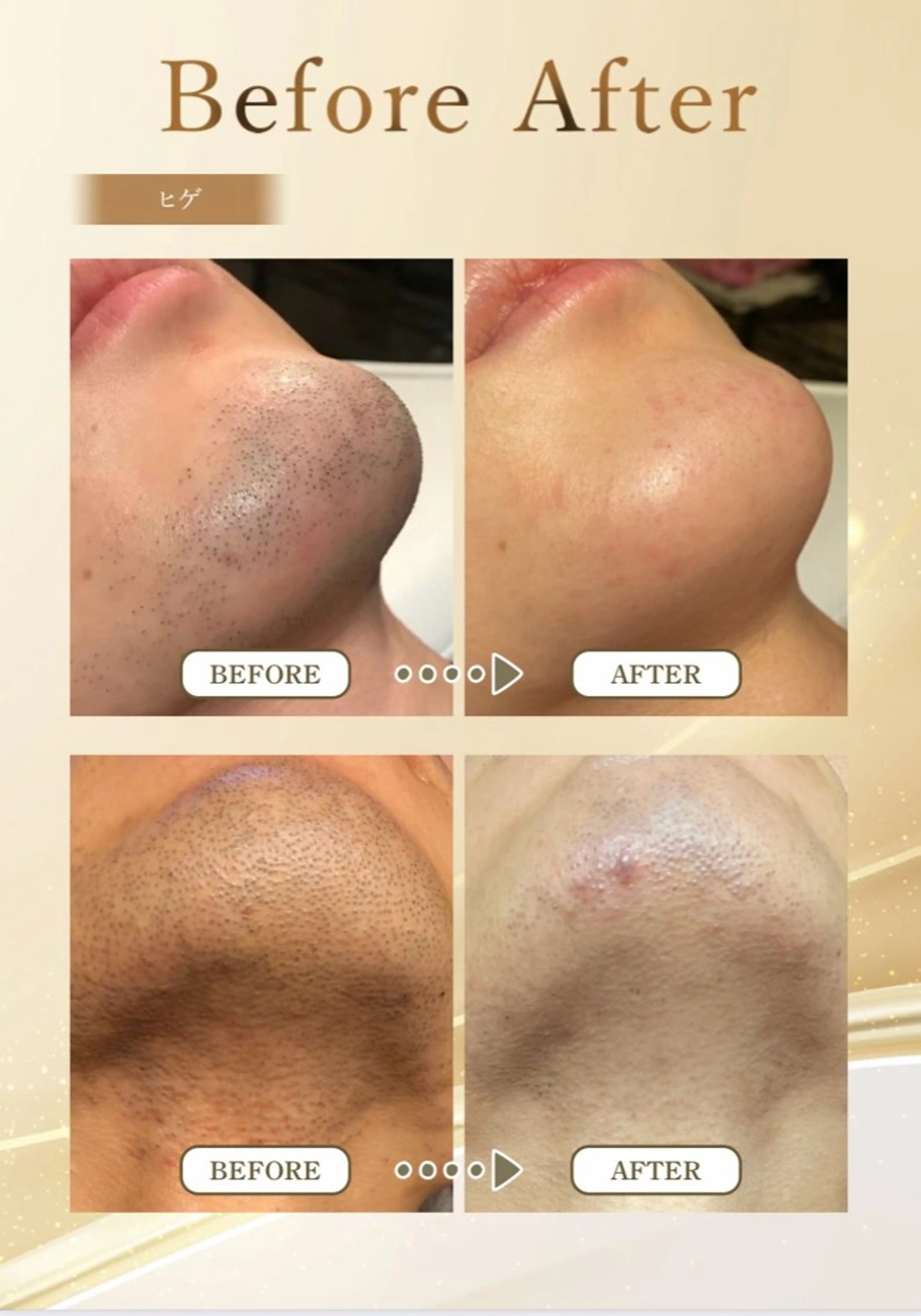 メンズ Ａ&Ｅ所属・西岡 /マツエク/束感🎀のマツエク・マツパデザイン