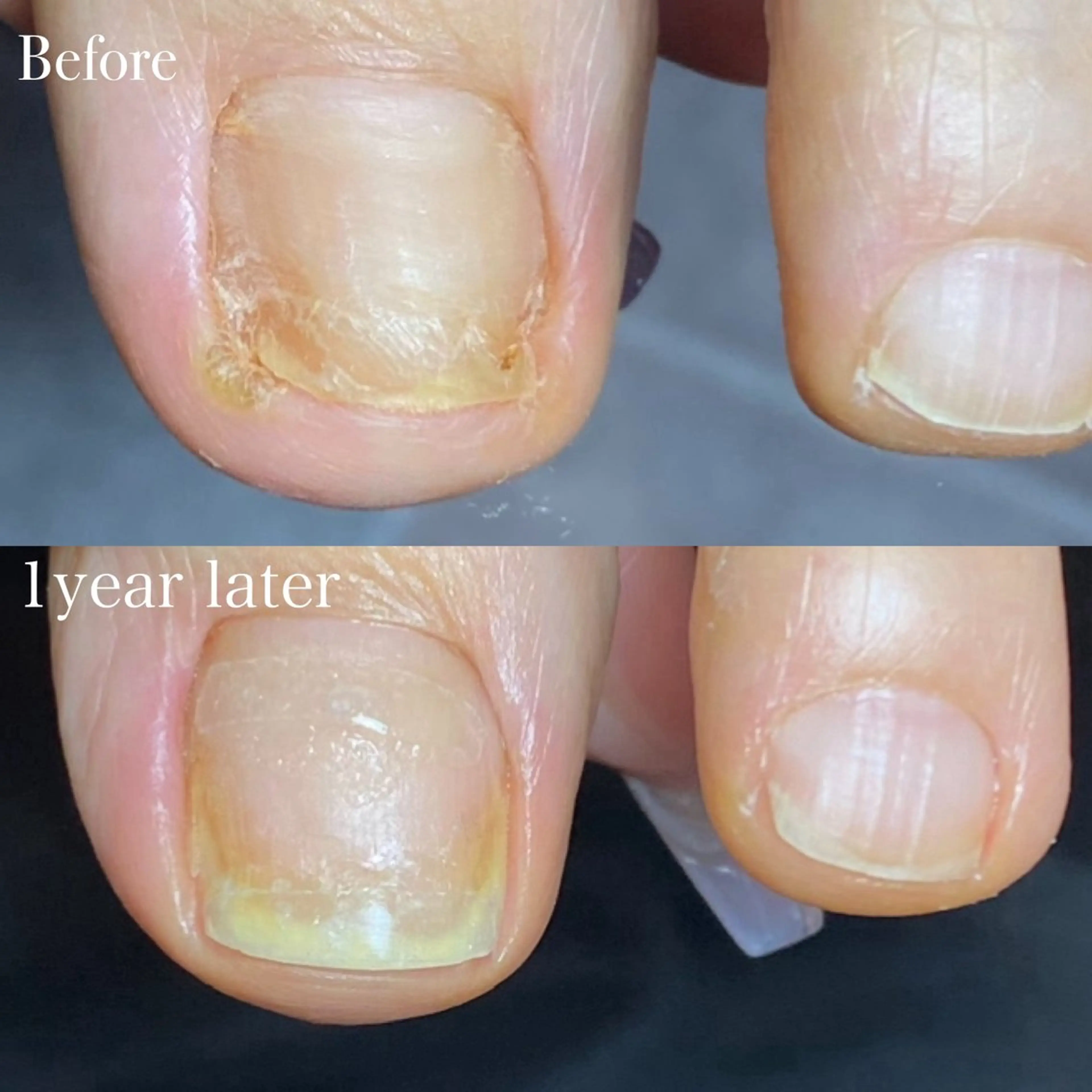 ネイル フットネイル フットネイル NailTailor ネイルテイラーのネイルデザイン