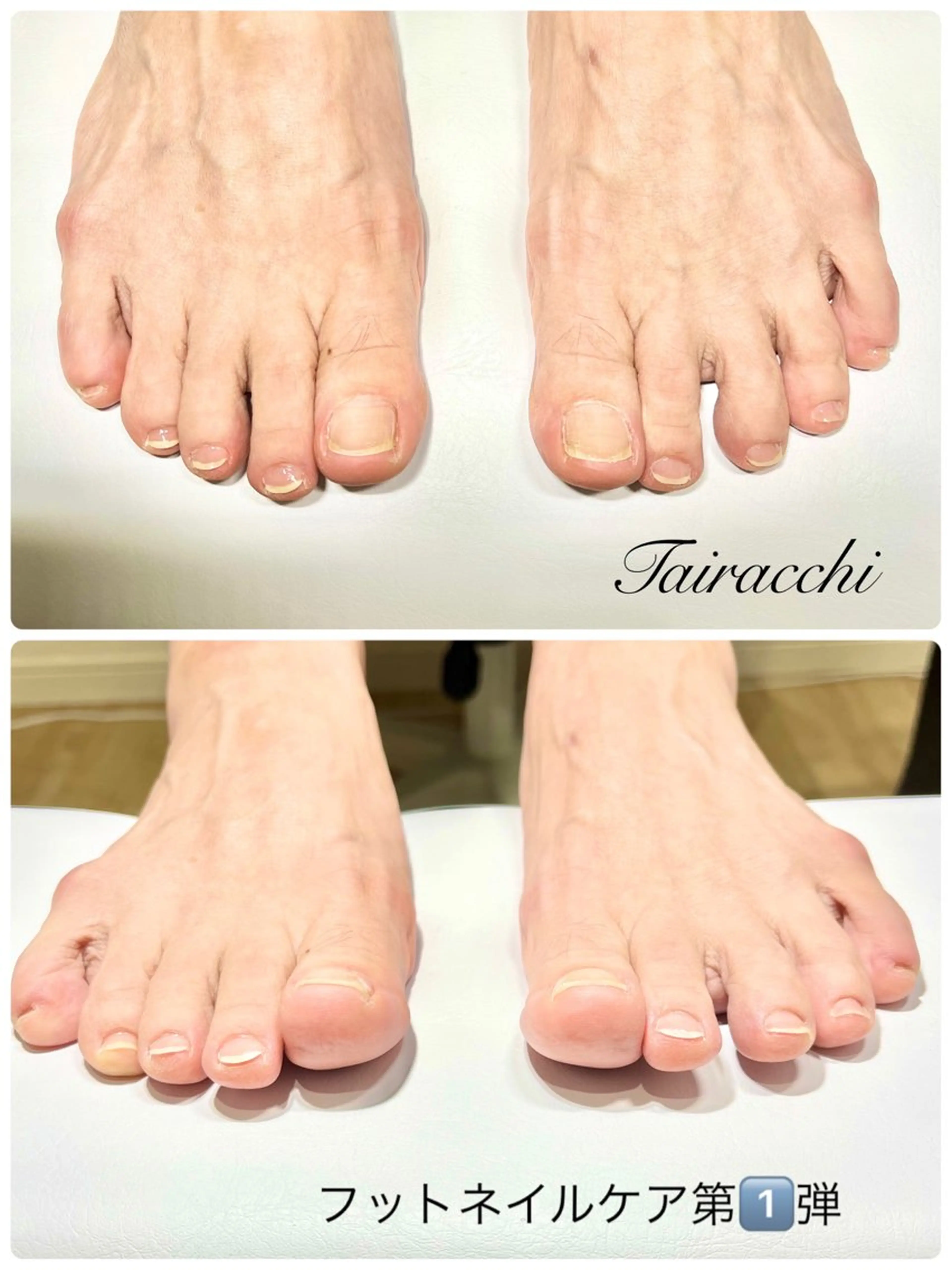ネイル フットネイル フットネイル Tairacchi タイラッチのネイルデザイン