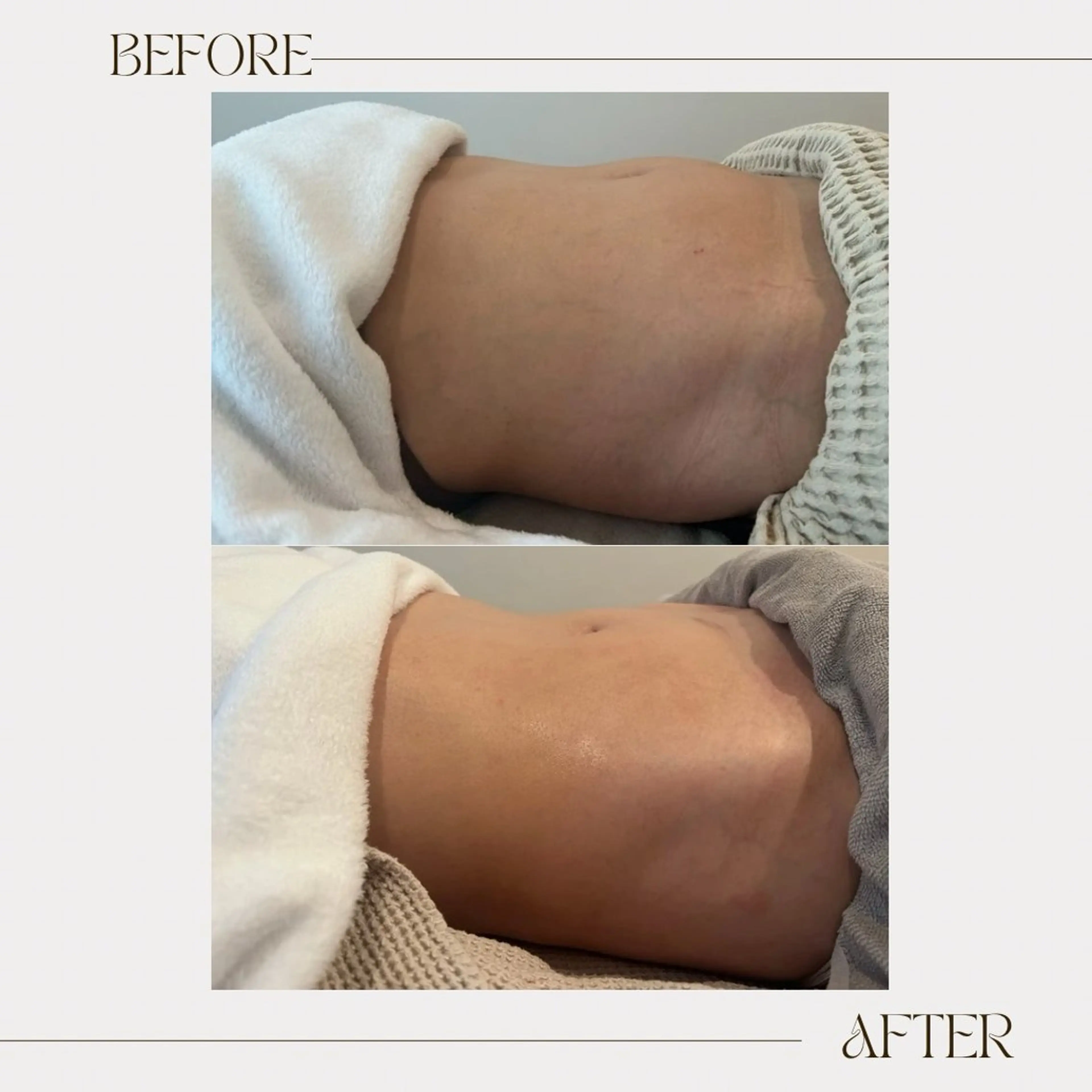 エステ リラク CONSTANT 🌿腸もみサロン🌿のエステ・リラクイメージ