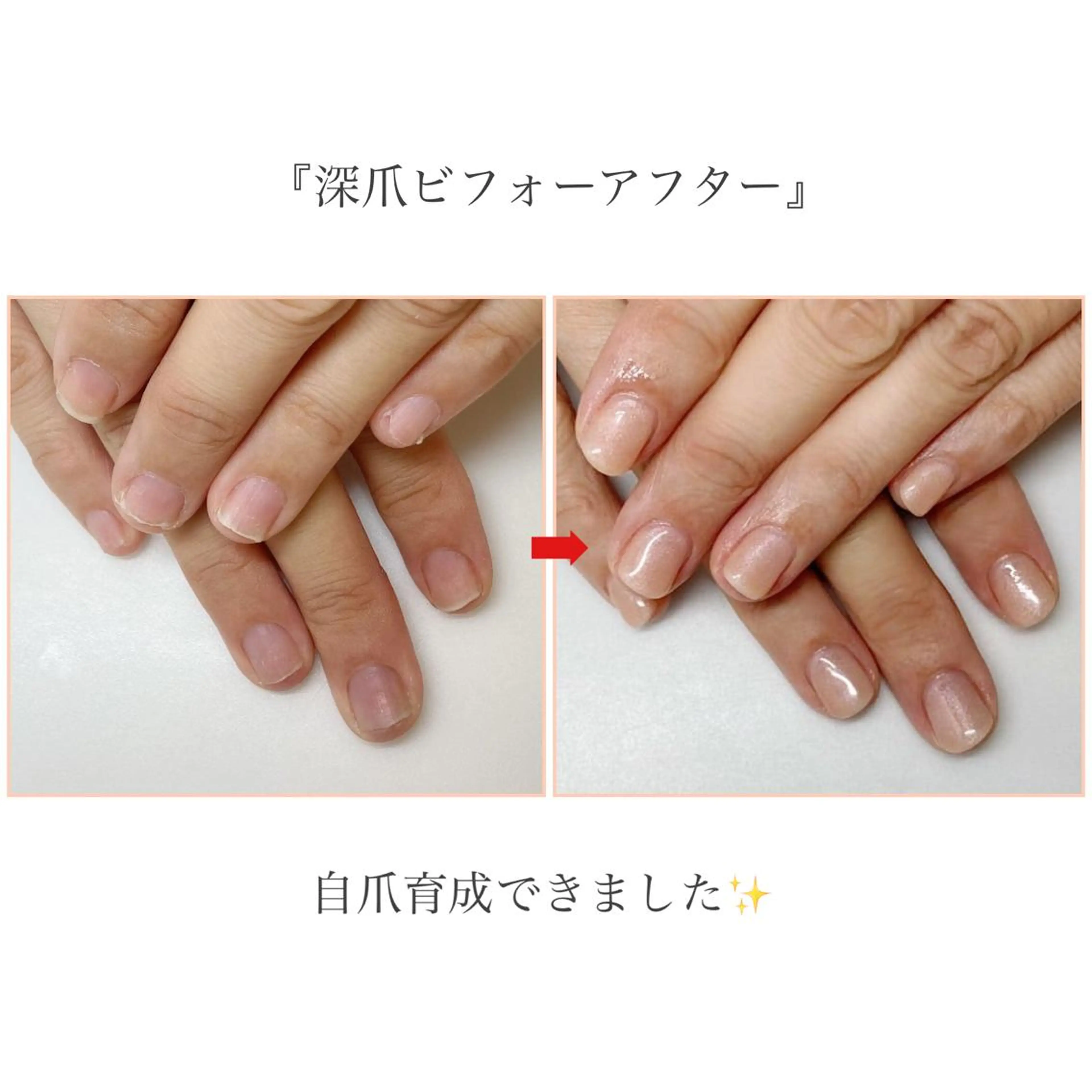 ネイル ネイルサロン アリュームのネイルデザイン