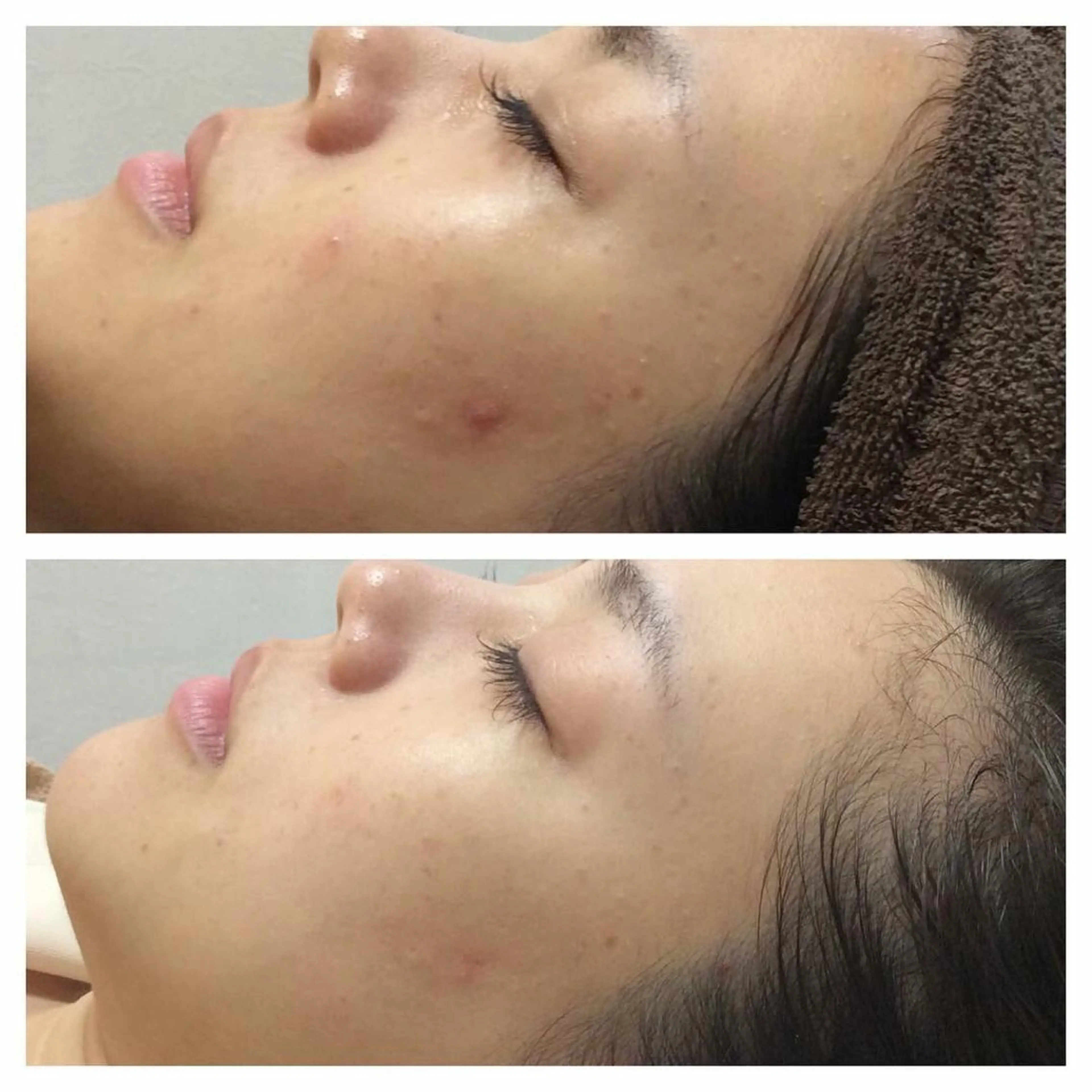 エステ 医師推奨サロン ディーキャットリーのエステ・リラクイメージ