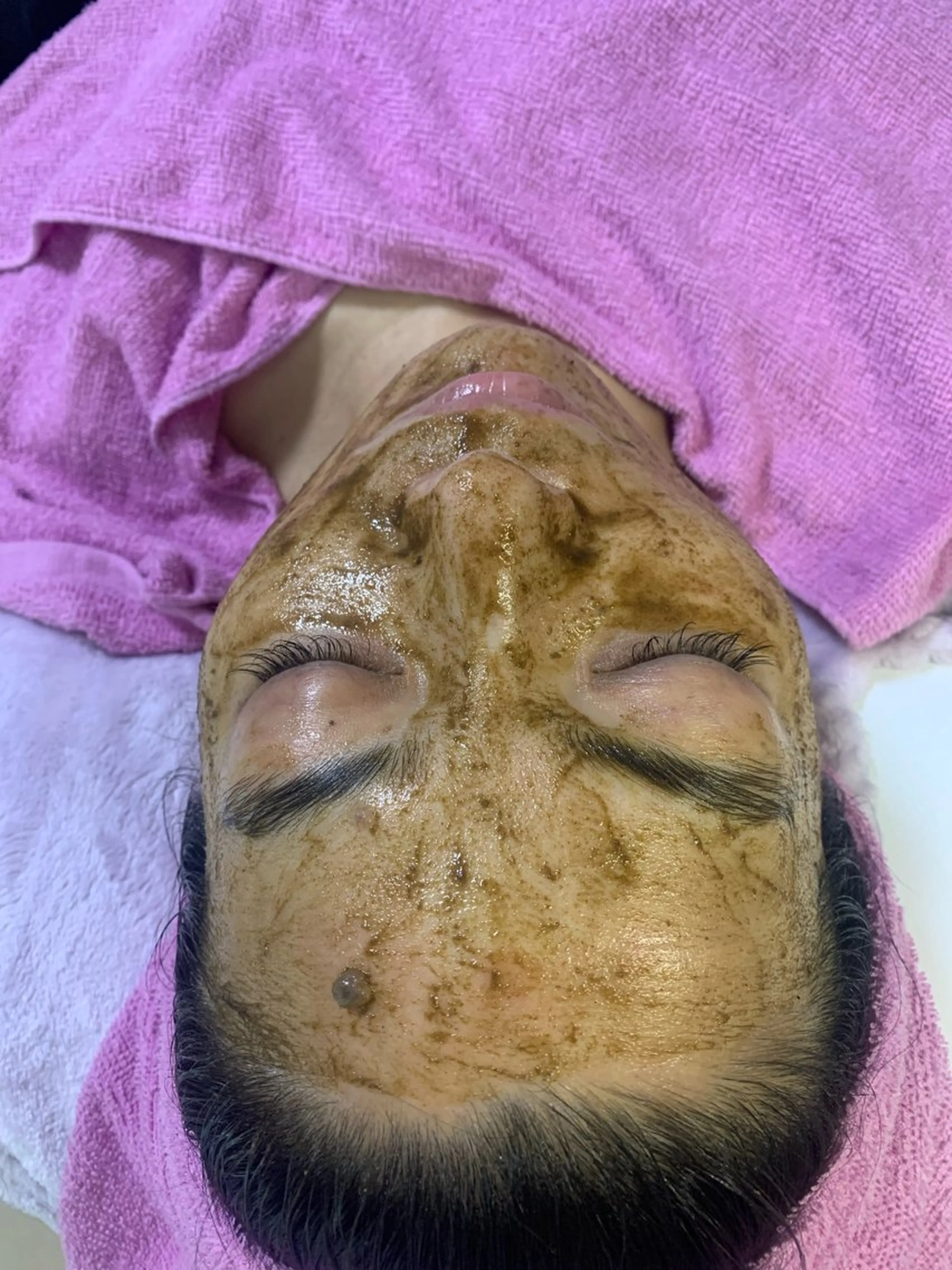 ハーブピーリングエステ新規様💆‍♀️ ヘッドandデコルテマッサージ込みの写真