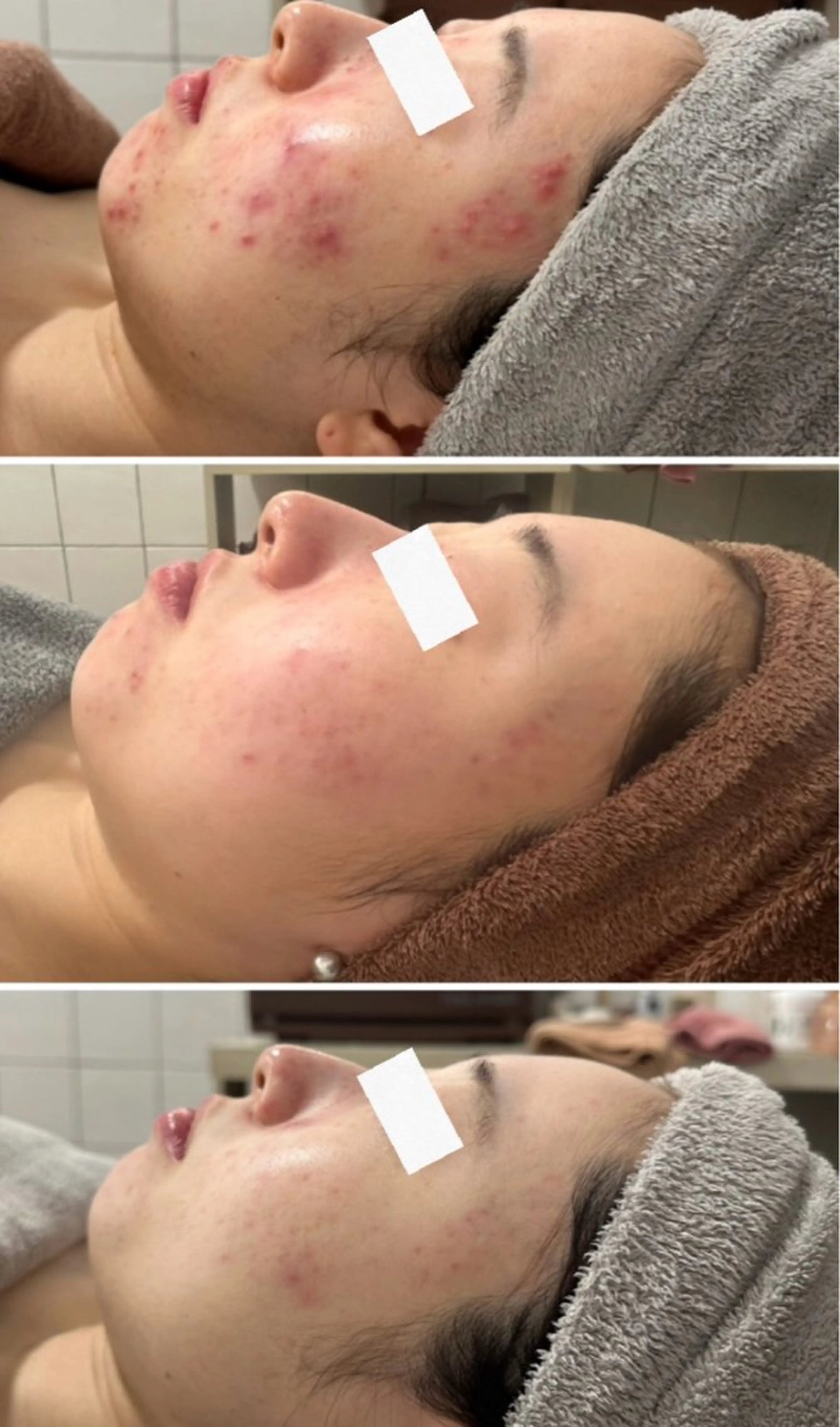 エステ ÉLAN クリニカルサロンのエステ・リラクイメージ