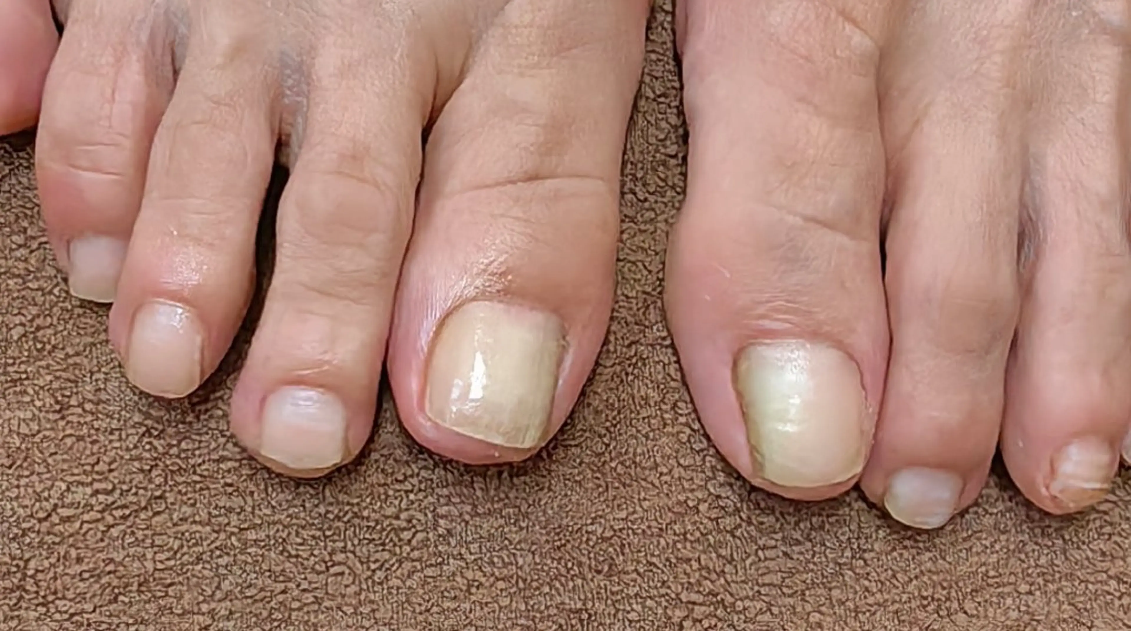 ネイル フットネイル reve あやののネイルデザイン