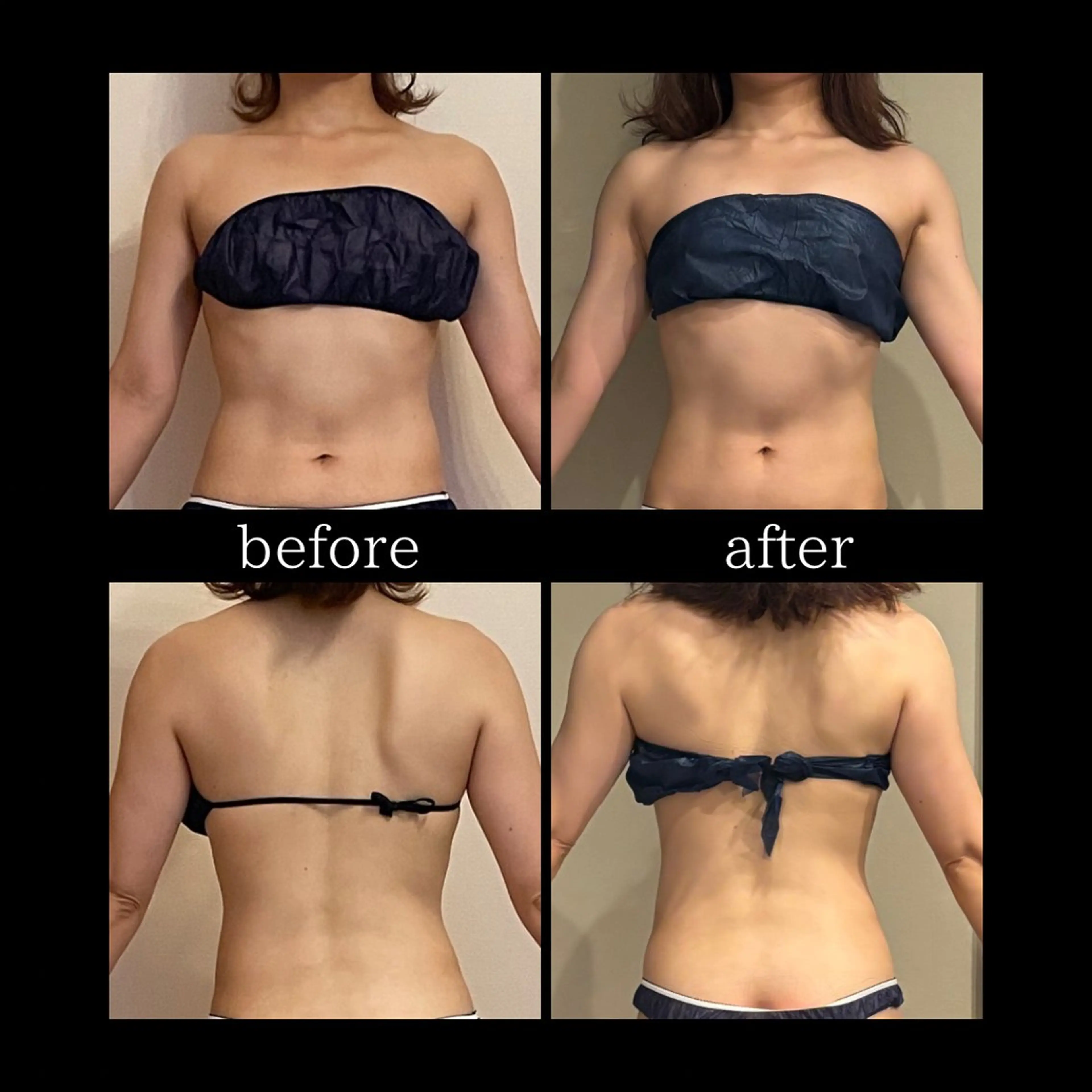 *仮予約* 【ボディメイク・美軸リリース】《肩・首・お腹に◎》上半身スッキリ集中50分の写真