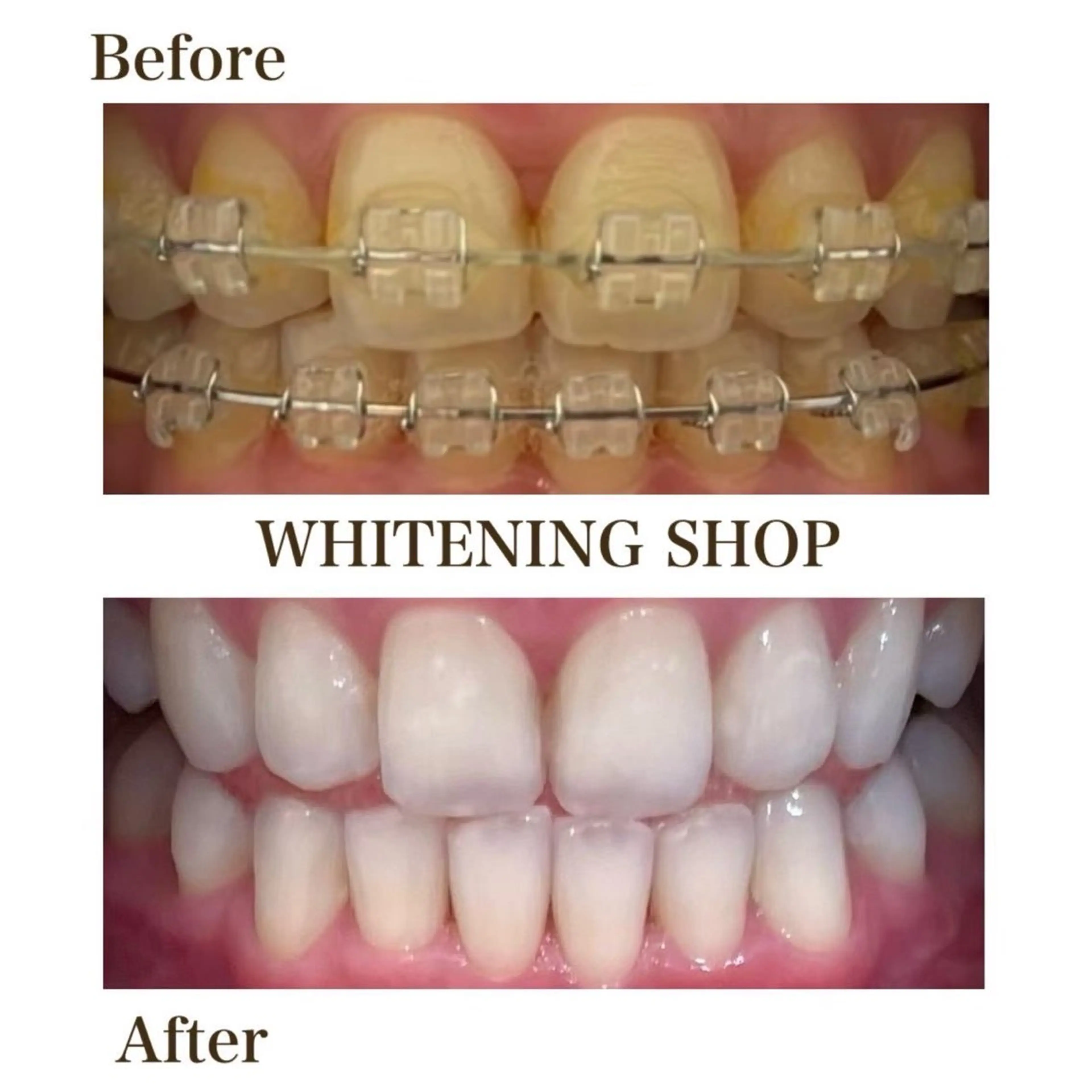 その他 ホワイトニングショップ津店所属・ホワイトニング ショップ津店のその他イメージ