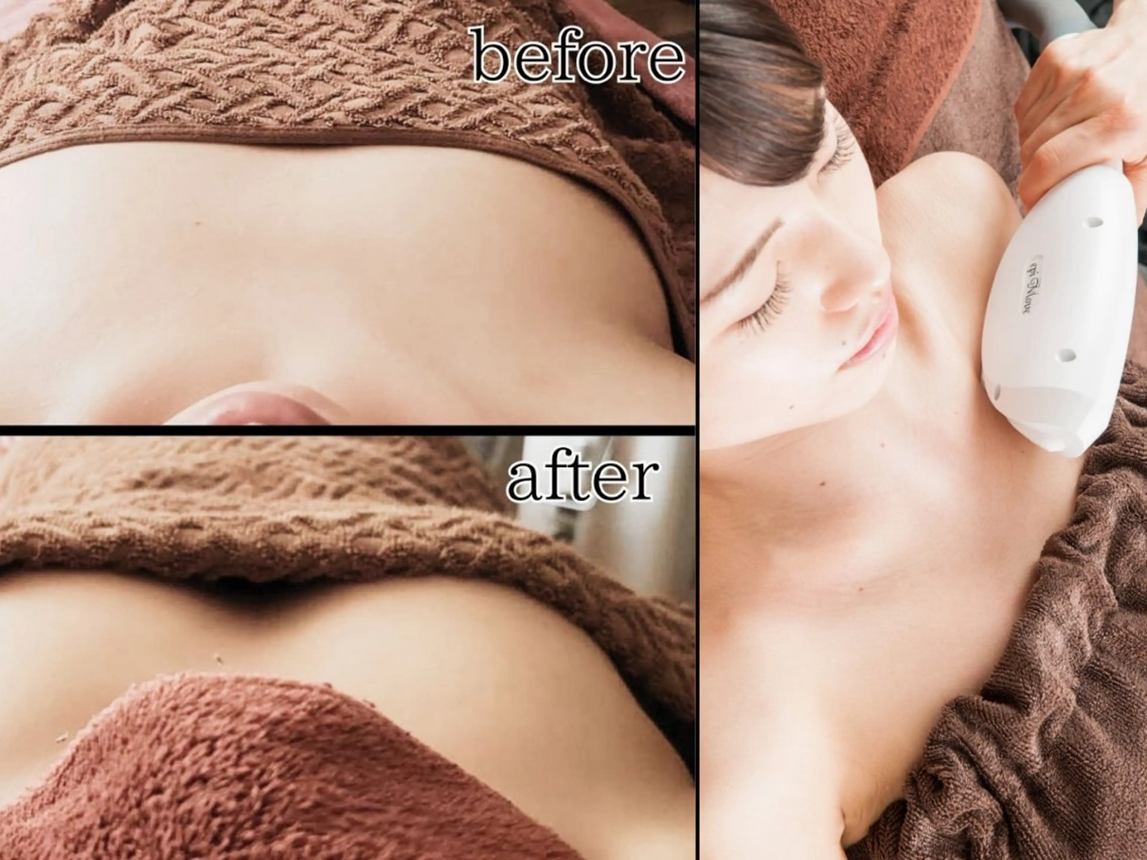 Frubran フルーブランのネイルデザイン