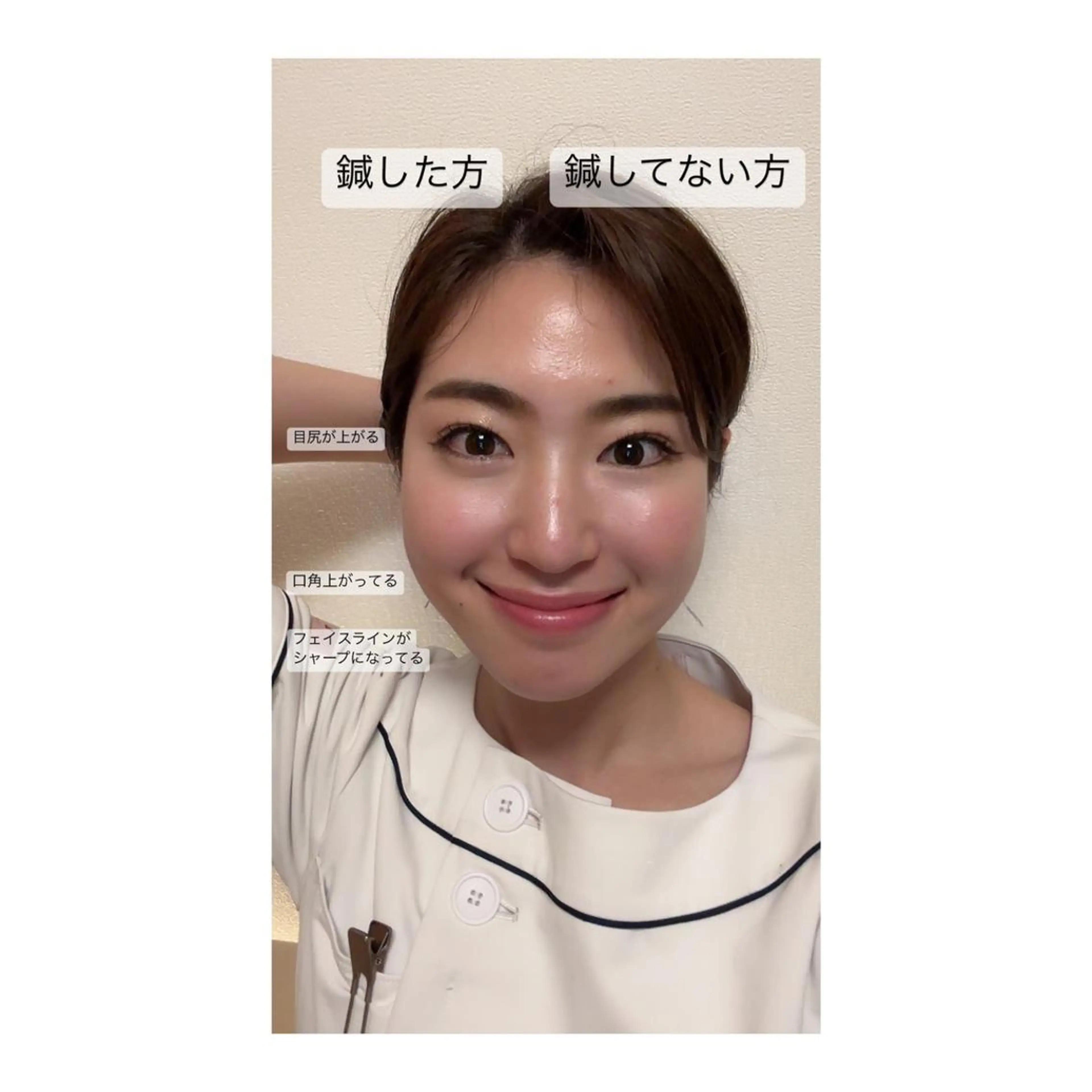 ショート カラー パーマ ヘアアレンジ メンズ キッズ ネイル マツエク・マツパ アイブロウ 小顔カット その他 即小顔♥️美容鍼× ハーブピーリングのその他イメージ