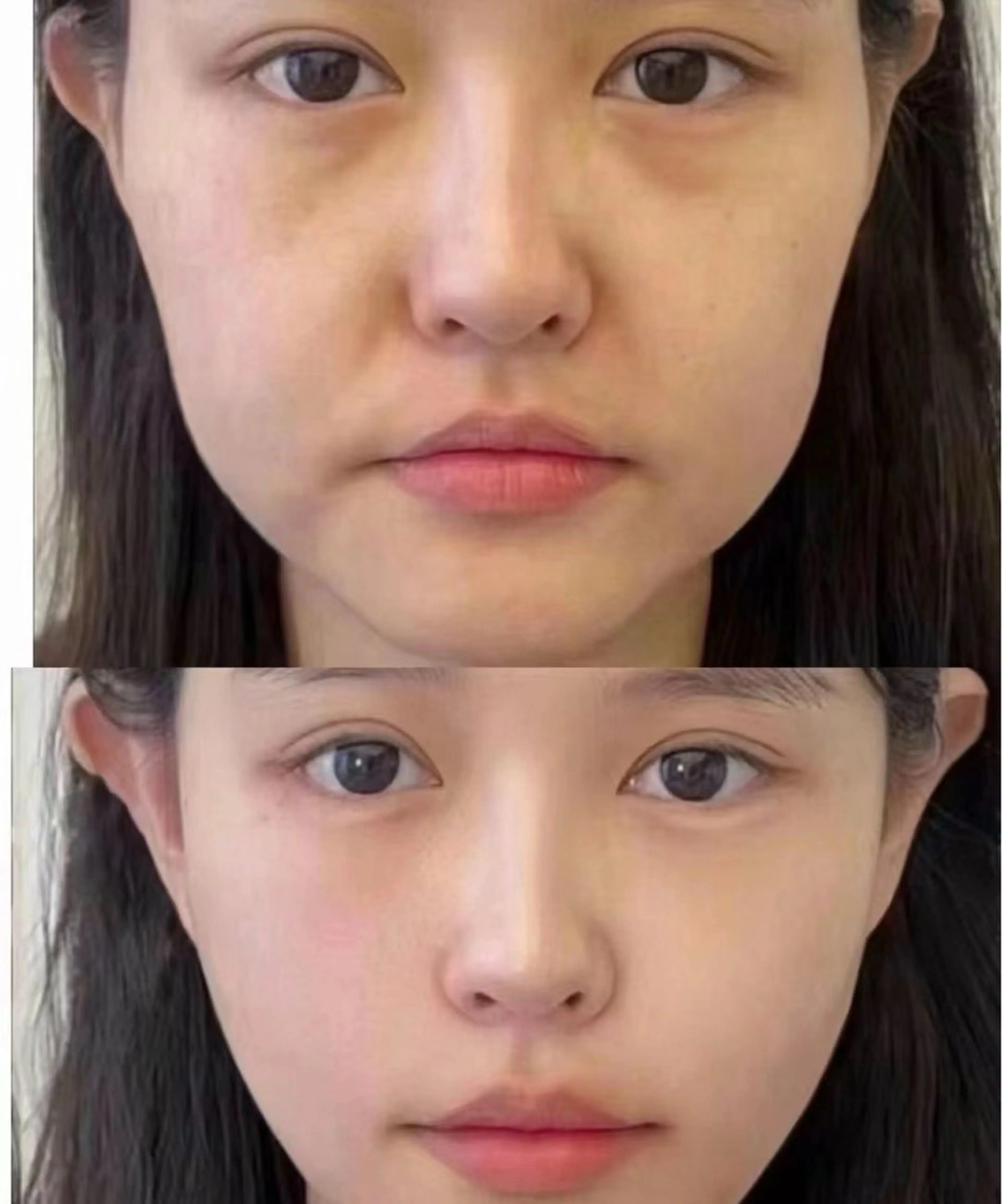 ネイル エステ aliaハーブ水光店 エステティシャン募集のエステ・リラクイメージ