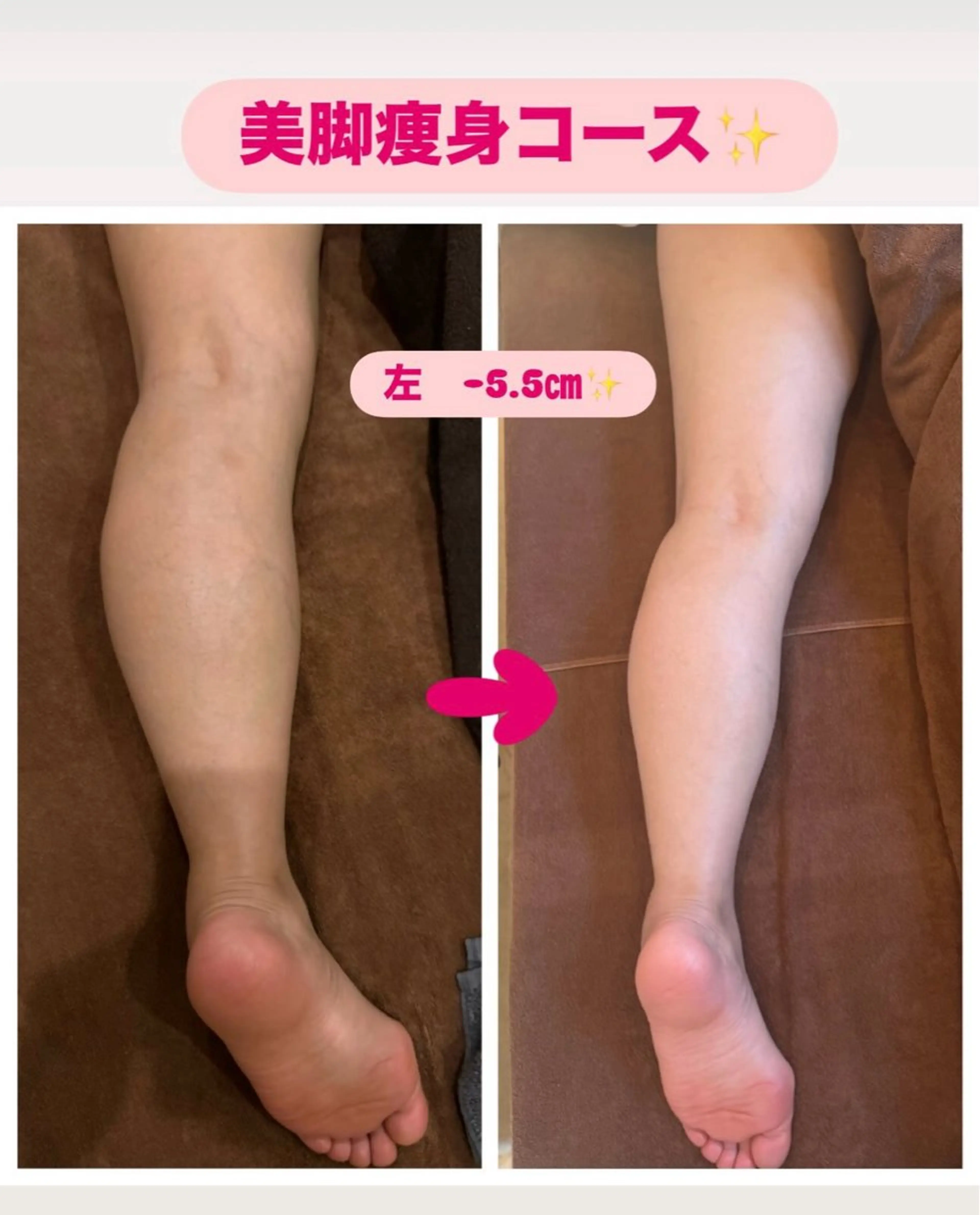 エステ リラク kawashima haruのネイルデザイン