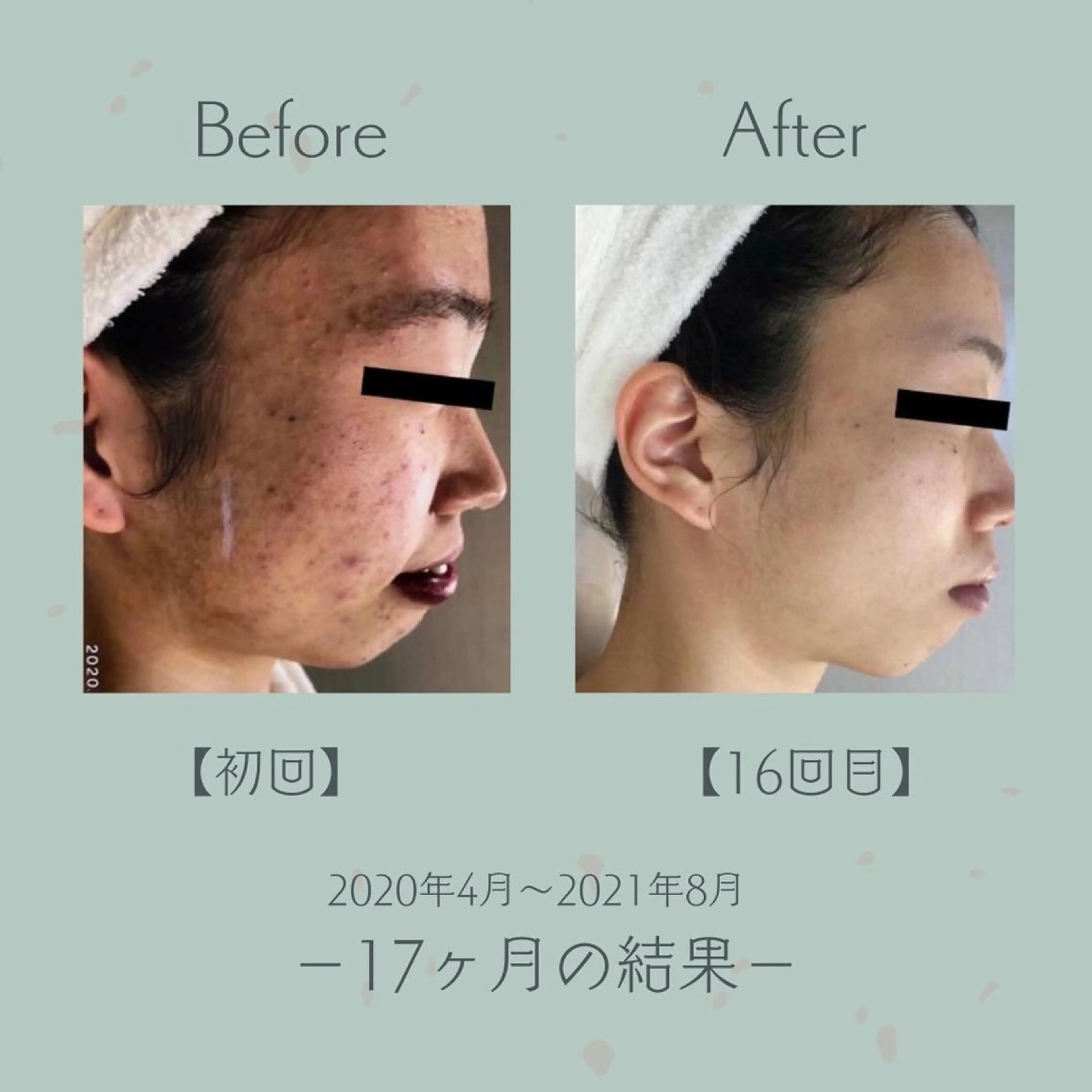 エステツイン広島店 FacialBodyのエステ・リラクイメージ