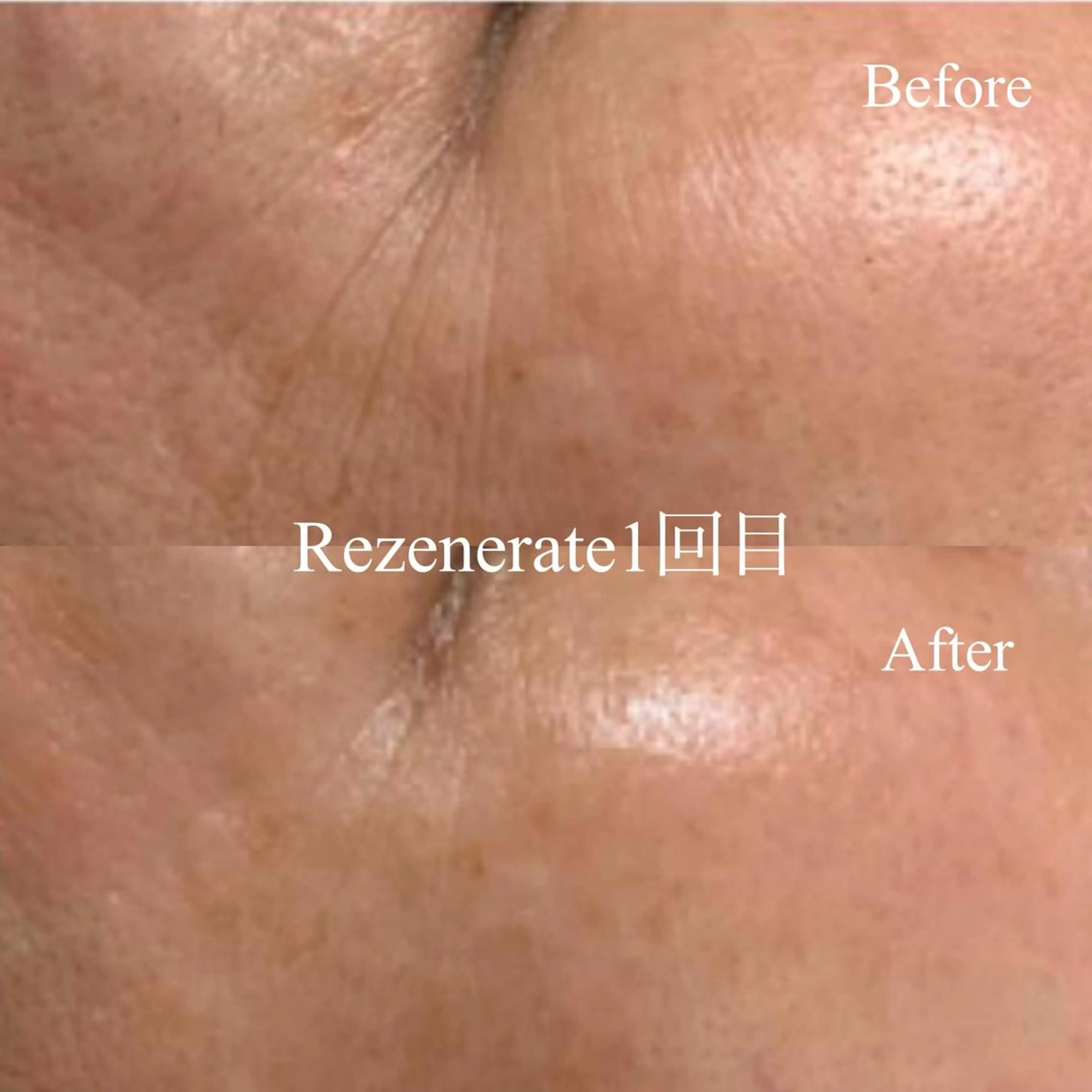 エステ Ailes de Ange MARIのエステ・リラクイメージ