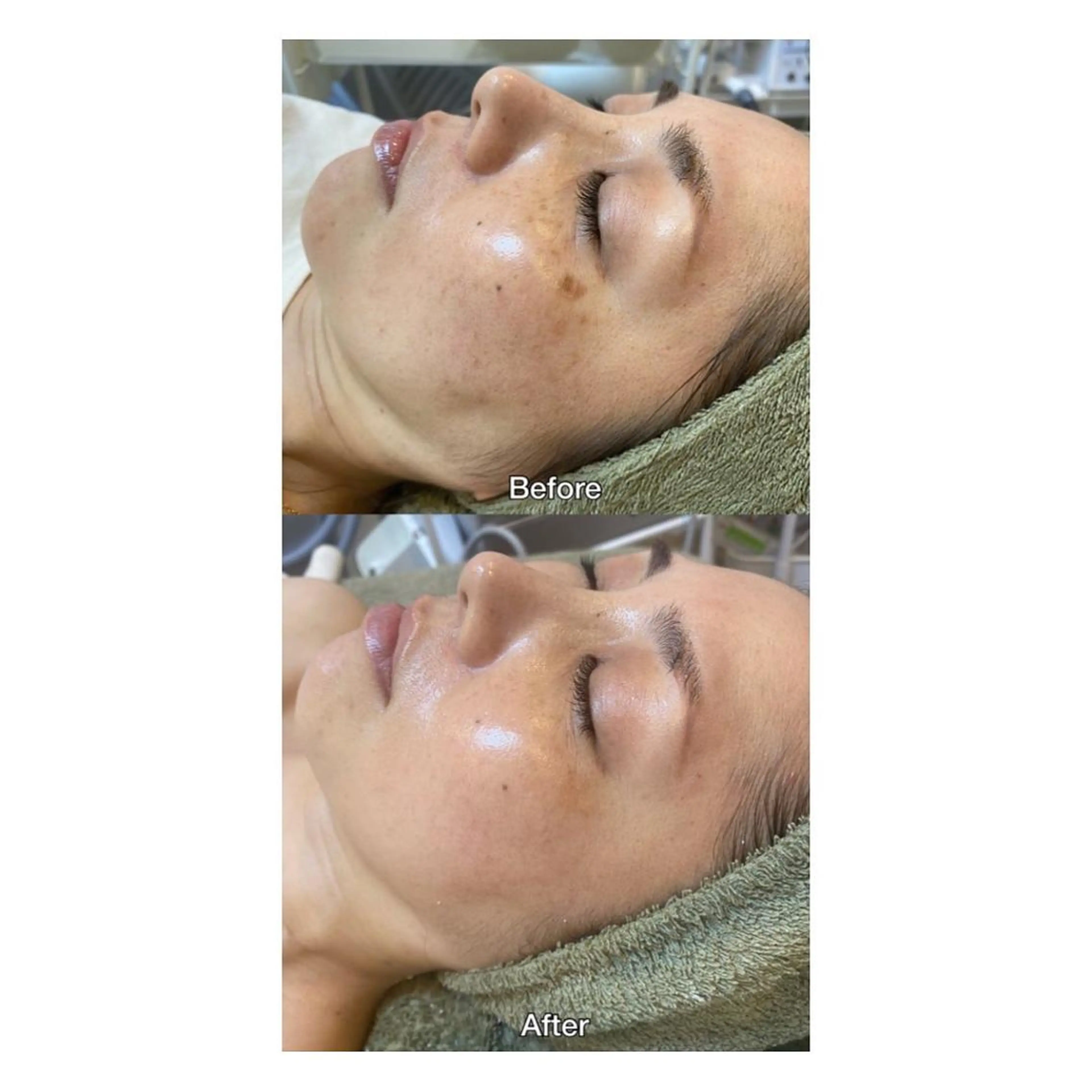 その他 ROOM.S |脱毛|美肌|ボディのエステ・リラクイメージ