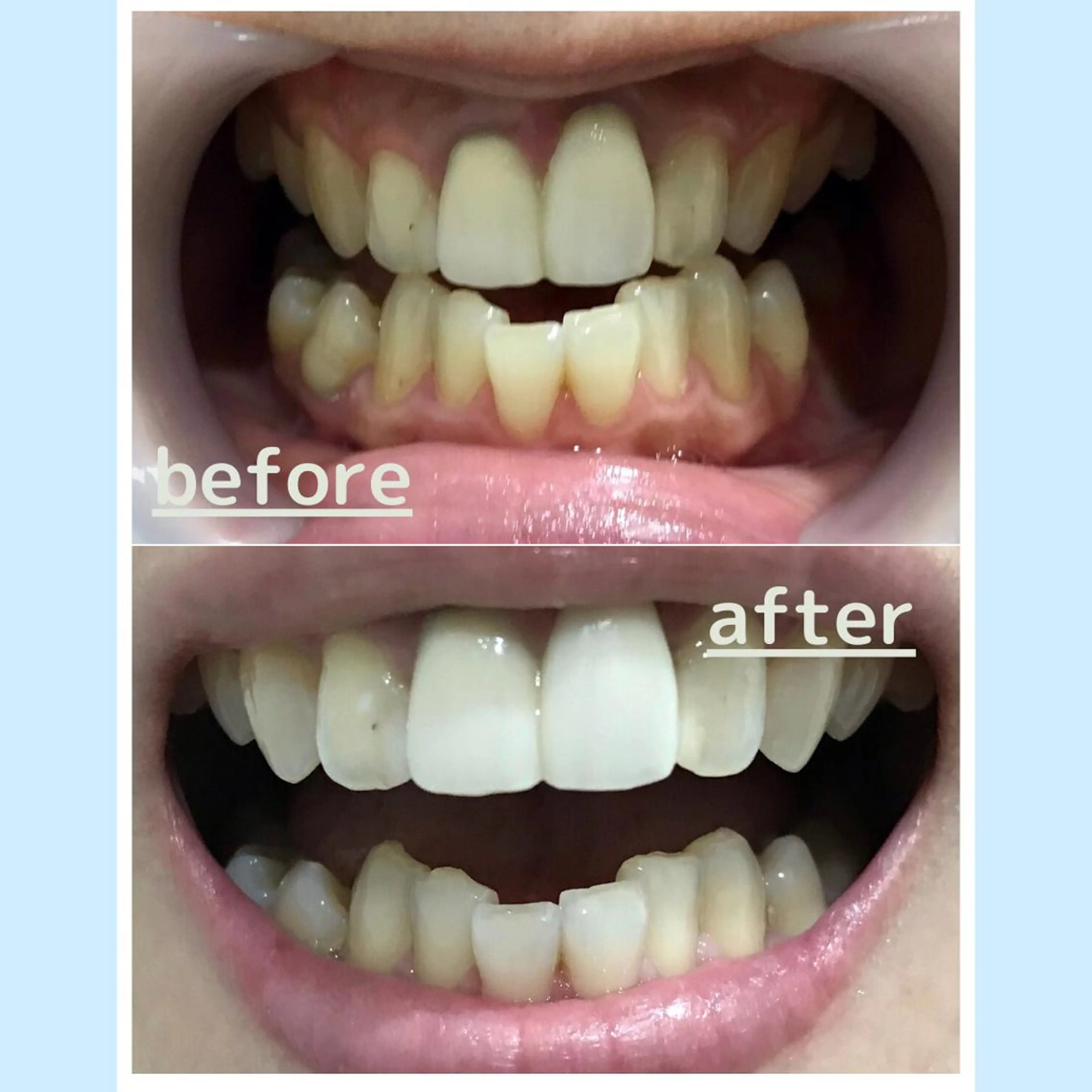 メンズ お手軽ホワイトニングsalon mina所属・武元 奈津美のその他イメージ