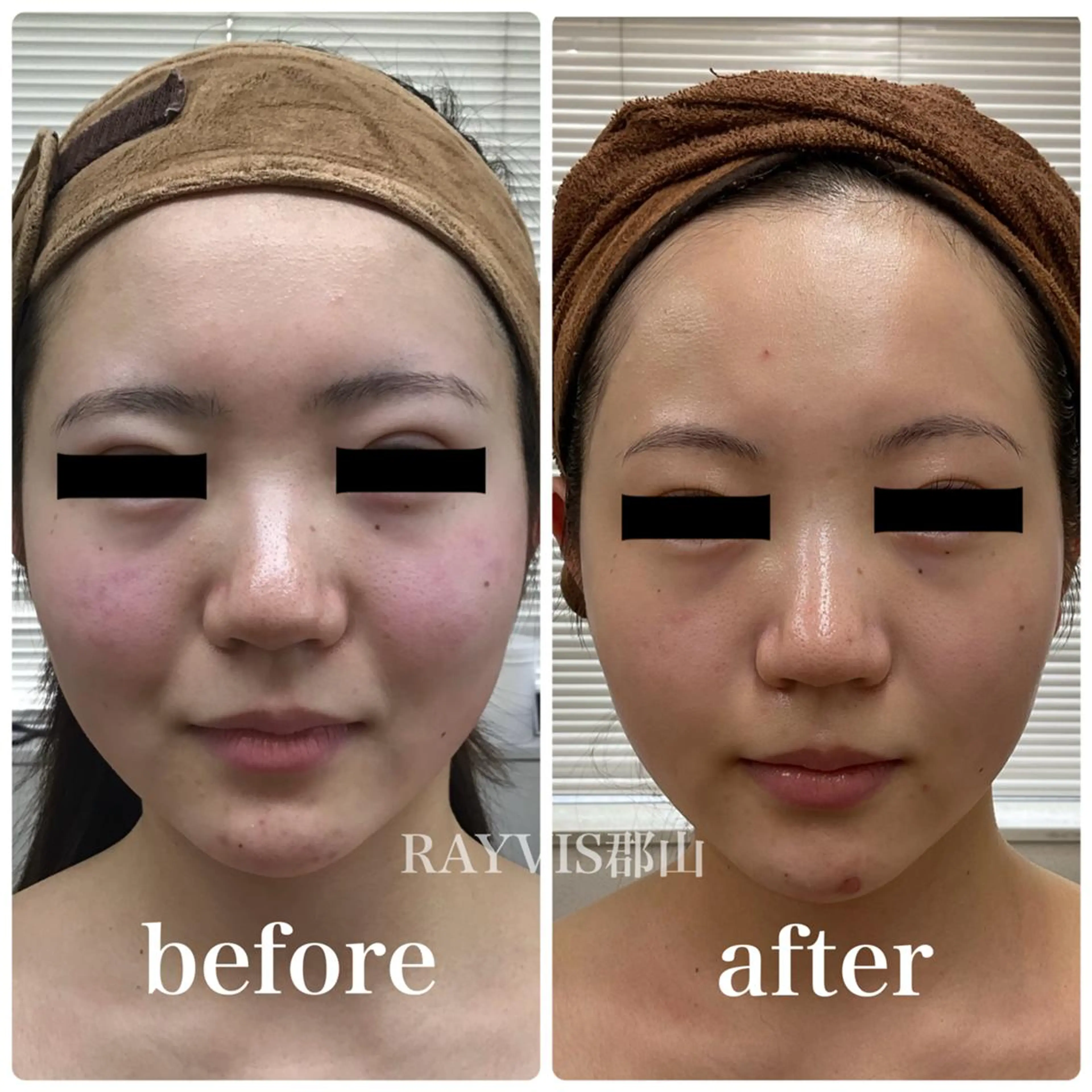 RAYVIS 郡山店のエステ・リラクイメージ