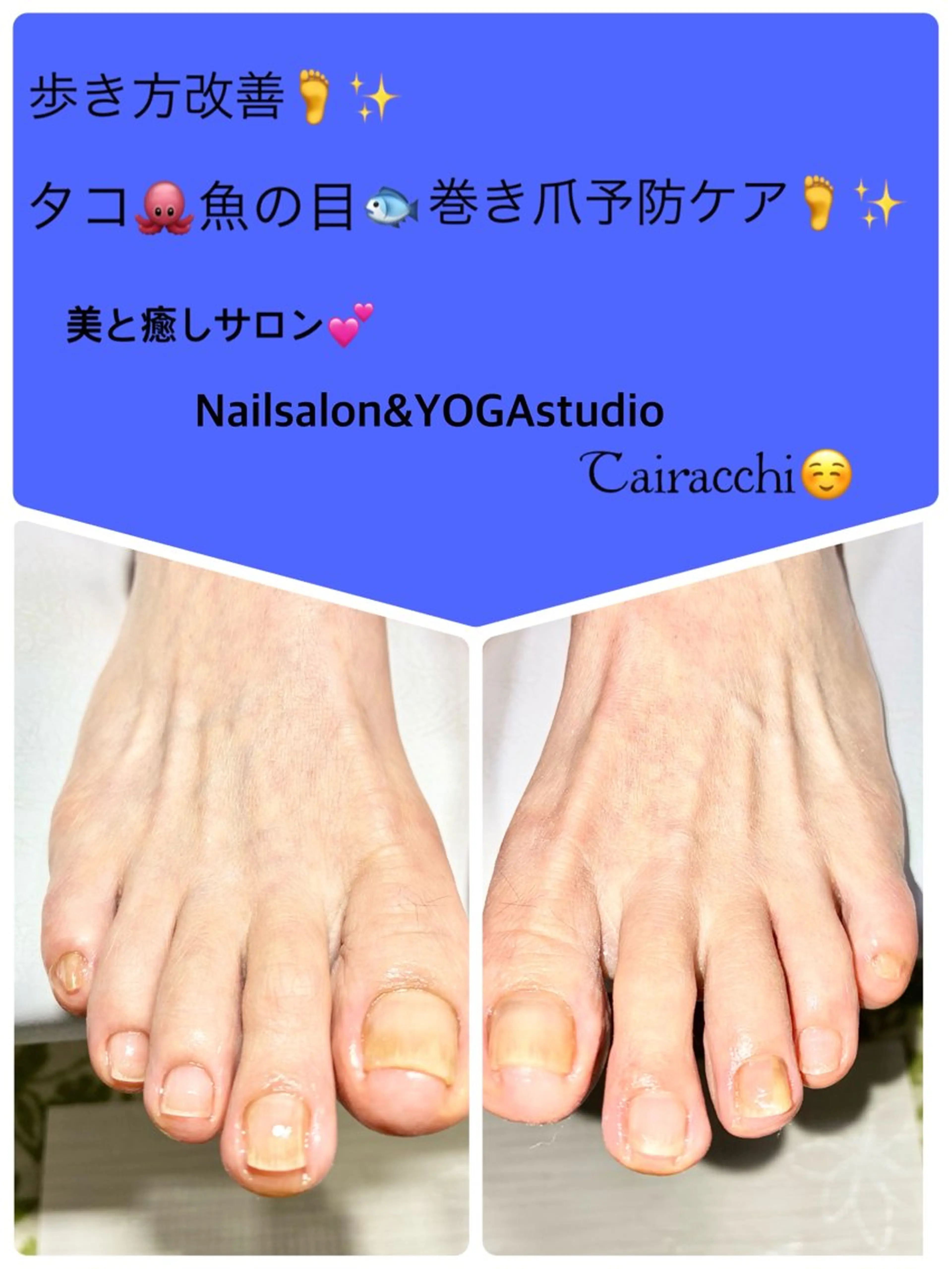 ネイル フットネイル フットネイル Tairacchi タイラッチのエステ・リラクイメージ