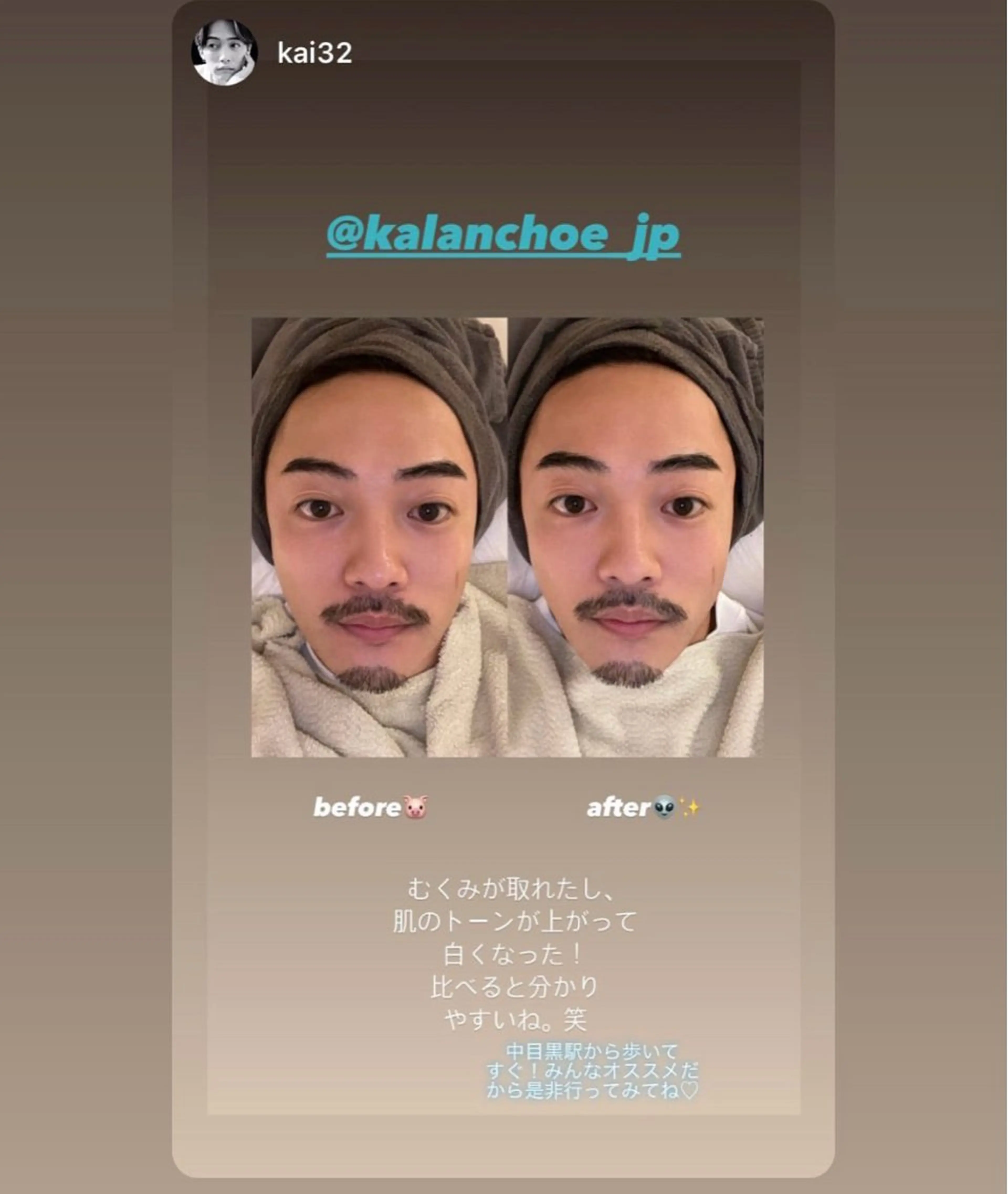 エステ 肌質改善 KALANCHOEのエステ・リラクイメージ