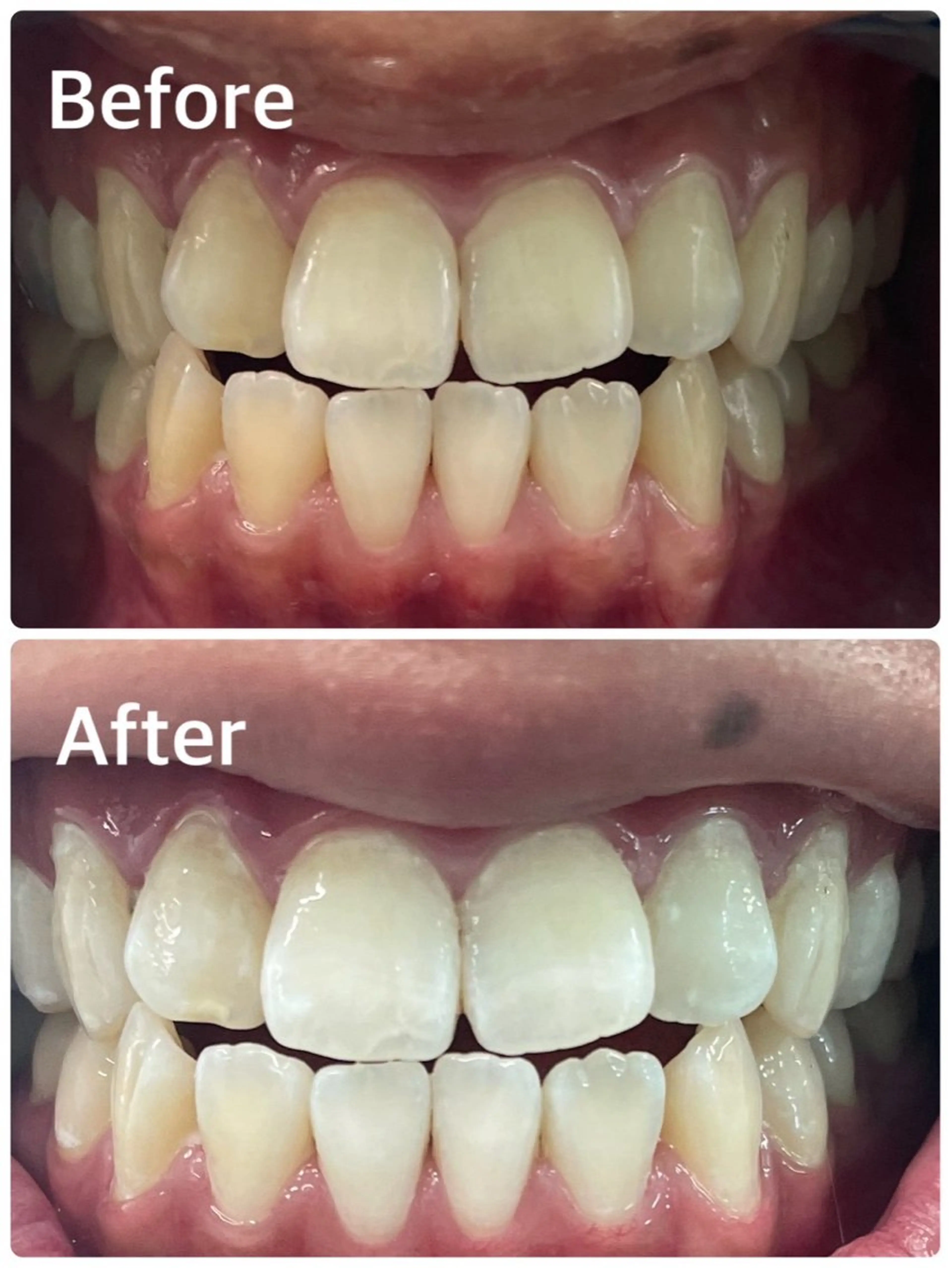 エステ プラチナム ビューティー横須賀店のその他イメージ