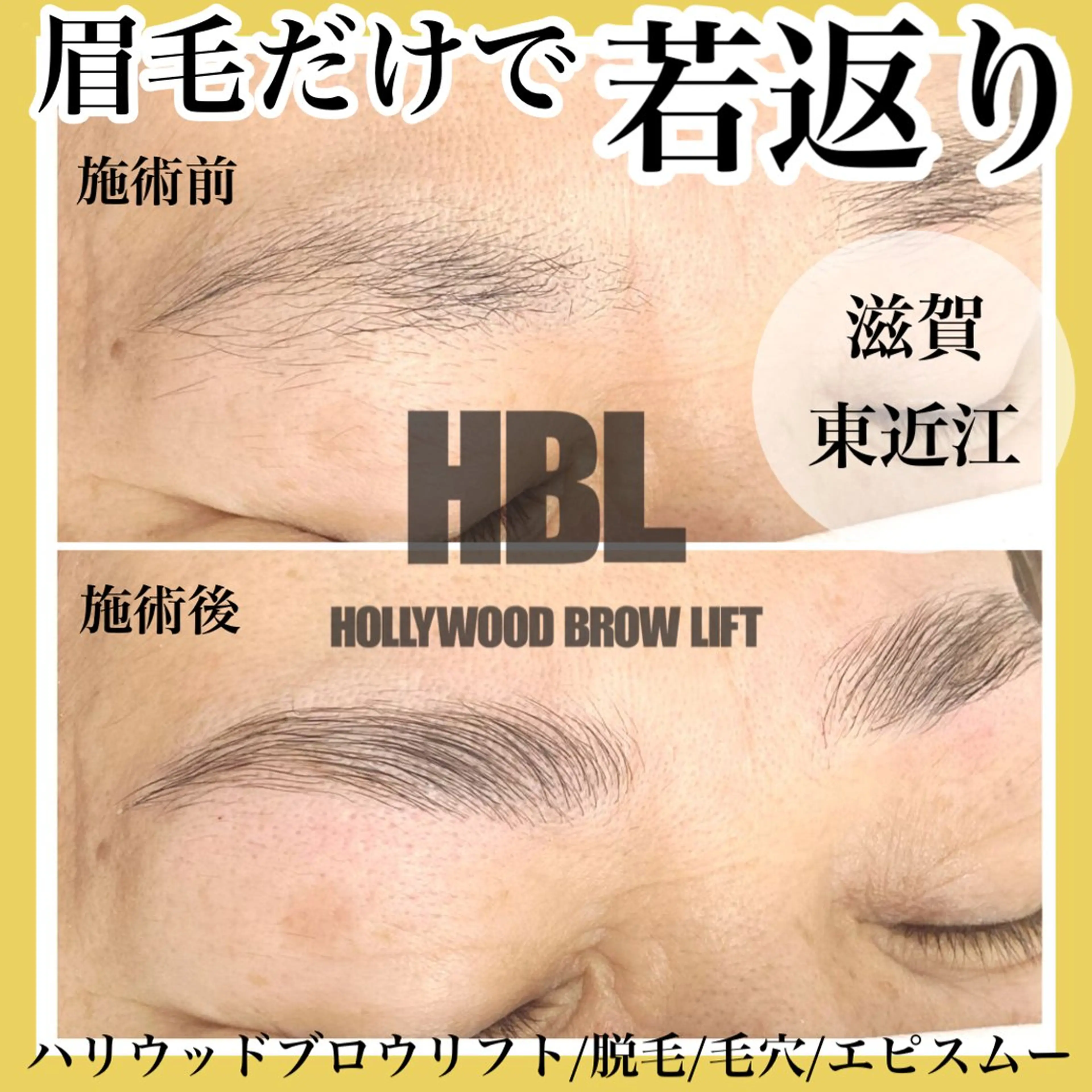 アイブロウ その他(アイブロウ) epismoo 脱毛/HBL/毛穴の眉毛・アイブロウイメージ