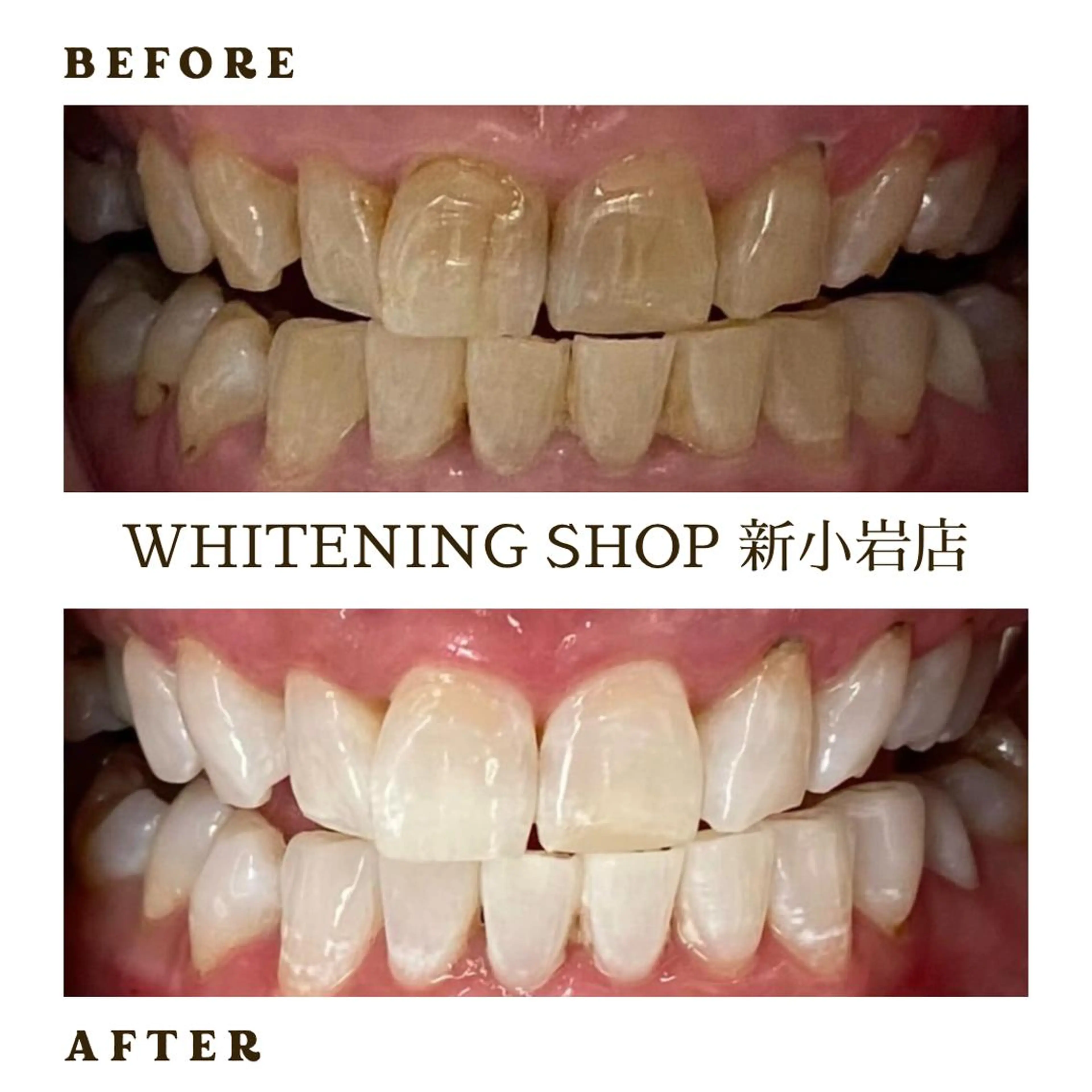 メンズ その他 ホワイトニング ショップ新小岩店のその他イメージ
