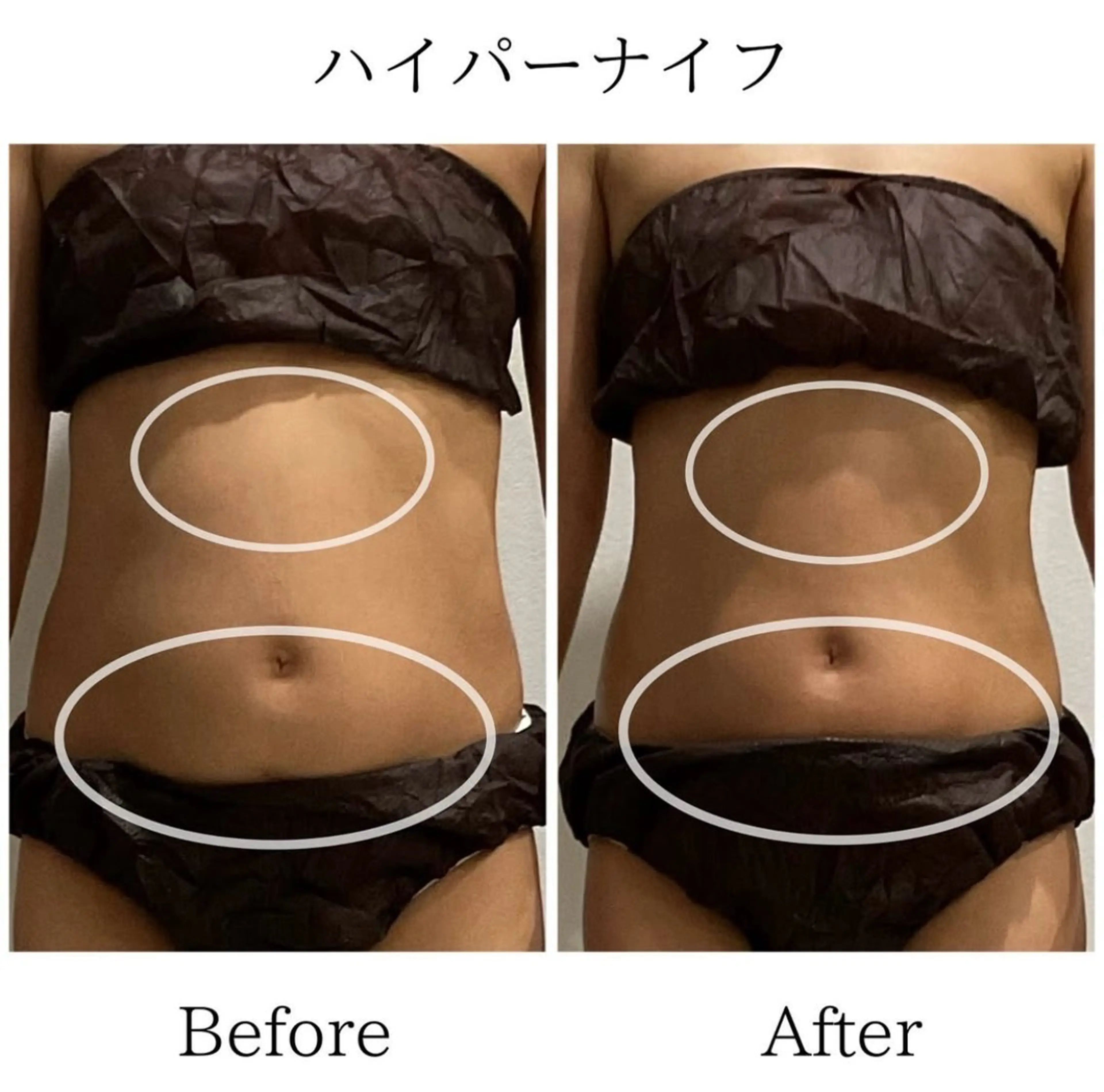 お腹痩せ🔥🔥ぽっこりお腹がキュッとくびれたウエストに💫　¥12,100→¥7,000の写真